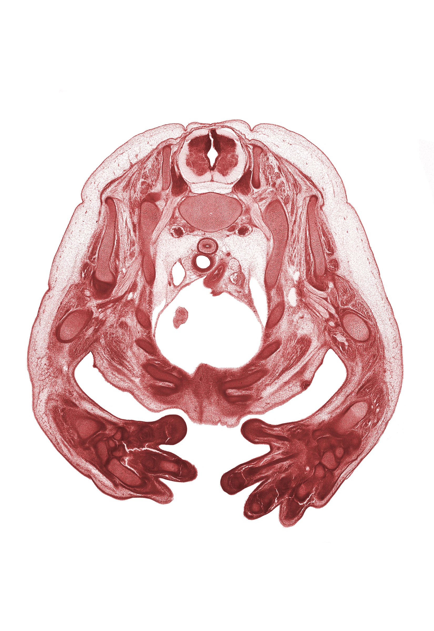 T-1 intercostal nerve, T-1 spinal ganglion, arch of aorta, artifact fracture(s), biceps brachii muscle, central canal, cephalic edge of right atrium, cephalic edge of right pleural cavity, inferior cervical sympathetic ganglion, left pleural cavity, left subclavian artery, metacarpal 3, osteogenic layer, pericardial cavity, radius, rhomboid minor muscle, rib 1, rib 2, rib 3, rib 4, superior vena cava, trachea, trapezius muscle