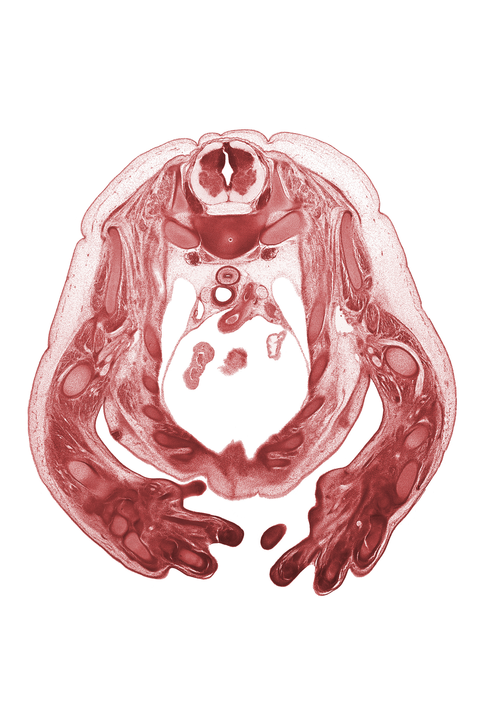 T-1 spinal ganglion, arch of aorta, auricle of right atrium, cephalic edge of right ventricle, head of rib 2, humerus, mammary gland, metacarpal 4, musculocutaneous nerve, notochord, pericardial cavity, radial nerve, rib 3, rib 4, rib 5, scapula, serratus anterior muscle, subscapularis muscle, superior vena cava, sympathetic trunk, triceps brachii muscle