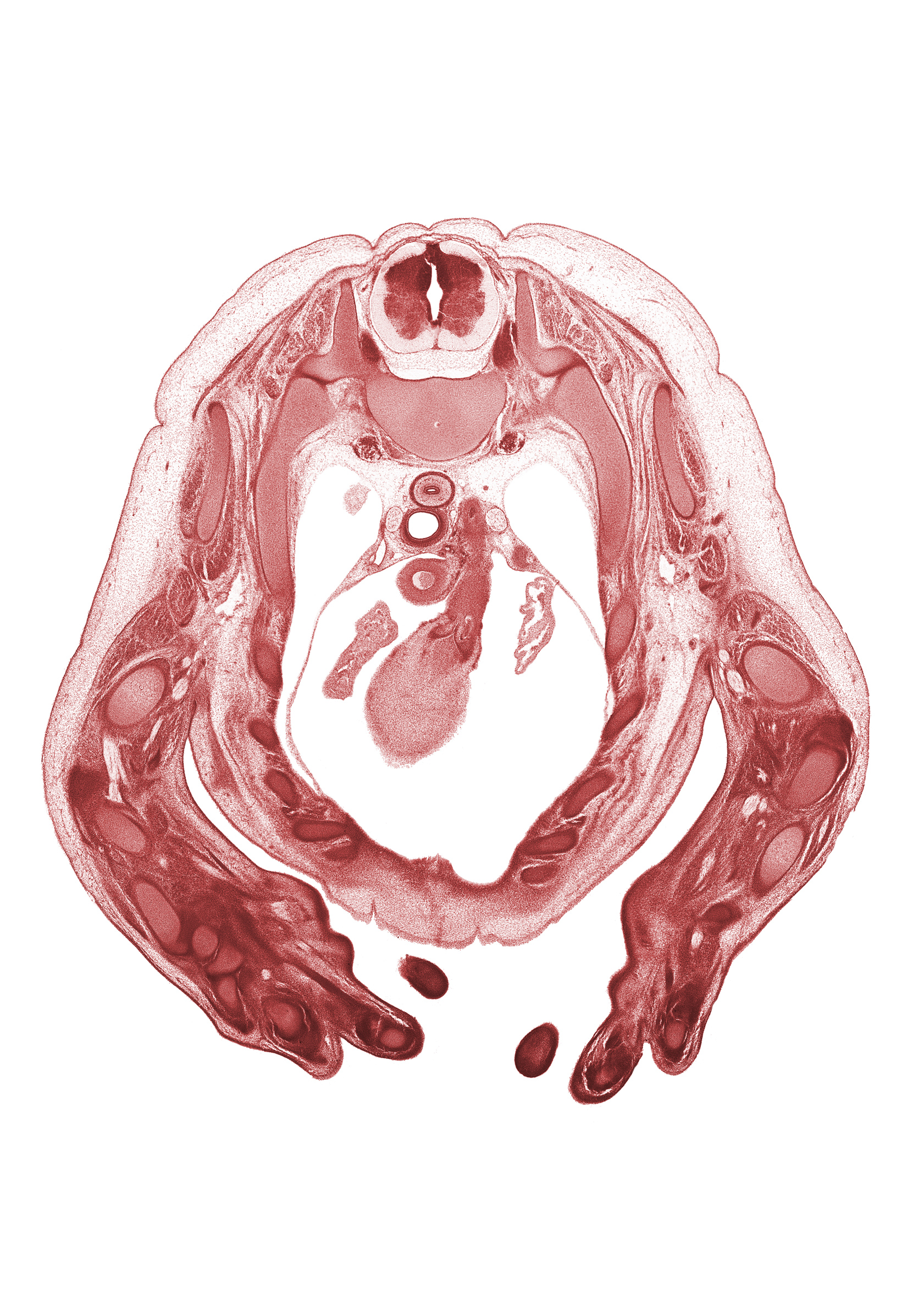 T-2 spinal ganglion, T-2 spinal nerve, apex of right lung, auricle of left atrium, auricle of right atrium, left vagus nerve (CN X), metacarpal 4, neural arch, pleural cavity, pulmonary semilunar valve, pulmonary trunk, radial nerve, radius, rib 2, right ventricle, serratus anterior muscle, superior vena cava, ulna