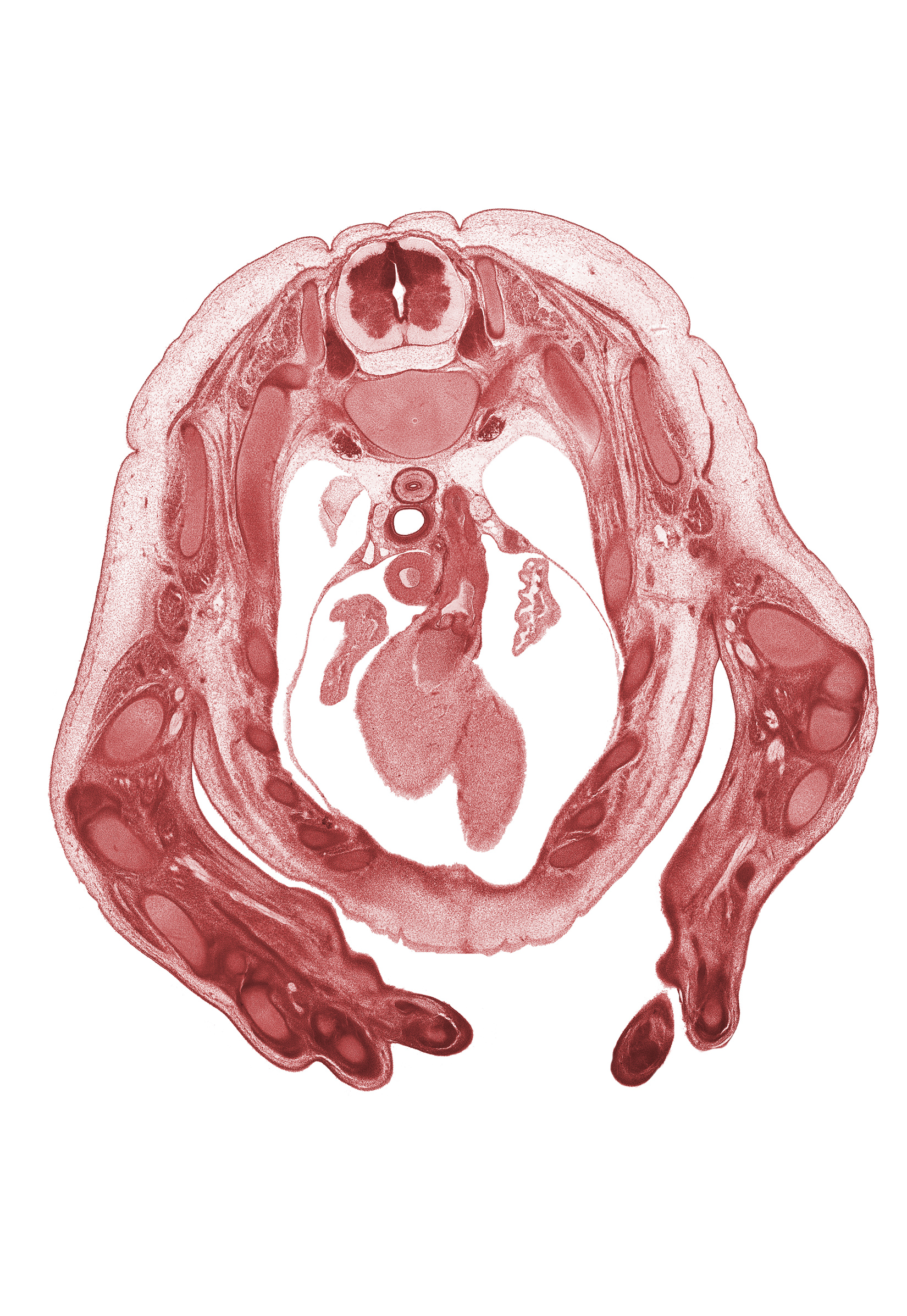 T-2 spinal ganglion, T-2 spinal nerve, auricle of left atrium, auricle of right atrium, cephalic edge of left ventricle, ductus arteriosus, heart prominence, interventricular sulcus, metacarpal 4, neural arch, notochord, osteogenic layer, pleural cavity, pulmonary semilunar valve, pulmonary trunk, right ventricle, scapula, sympathetic trunk, triceps brachii muscle, ulna