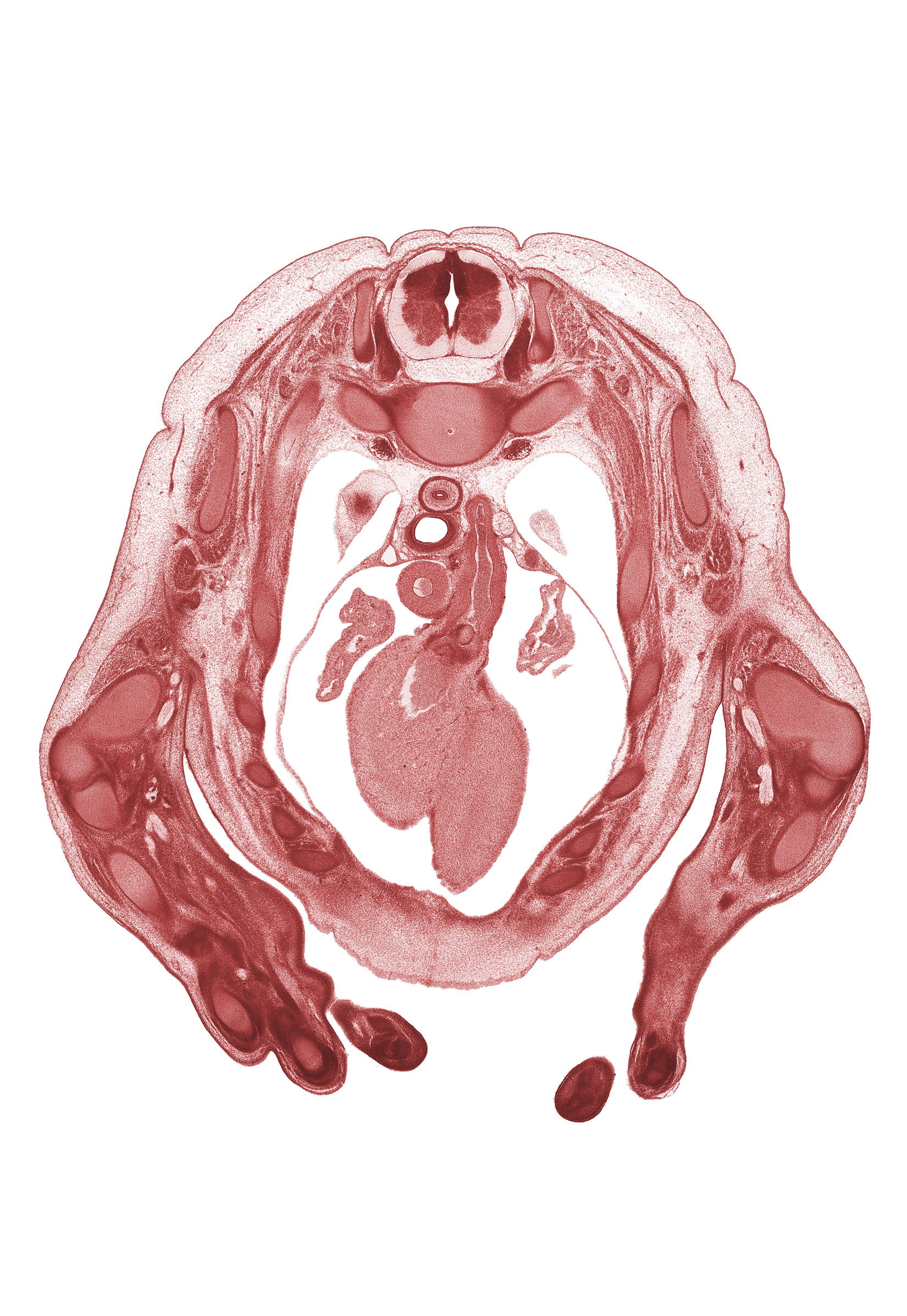 T-2 spinal ganglion, aorta, apex of left lung, arch of azygos vein, ascending aorta, auricle of left atrium, auricle of right atrium, ductus arteriosus, flexor muscles in forearm, head of radius, head of rib 3, infundibulum of right ventricle, intermediate zone, left ventricle, marginal zone, median nerve, metacarpal 4, pleural cavity, pulmonary semilunar valve, pulmonary trunk, right ventricle, scapula, teres major muscle, ulna, ventricular zone