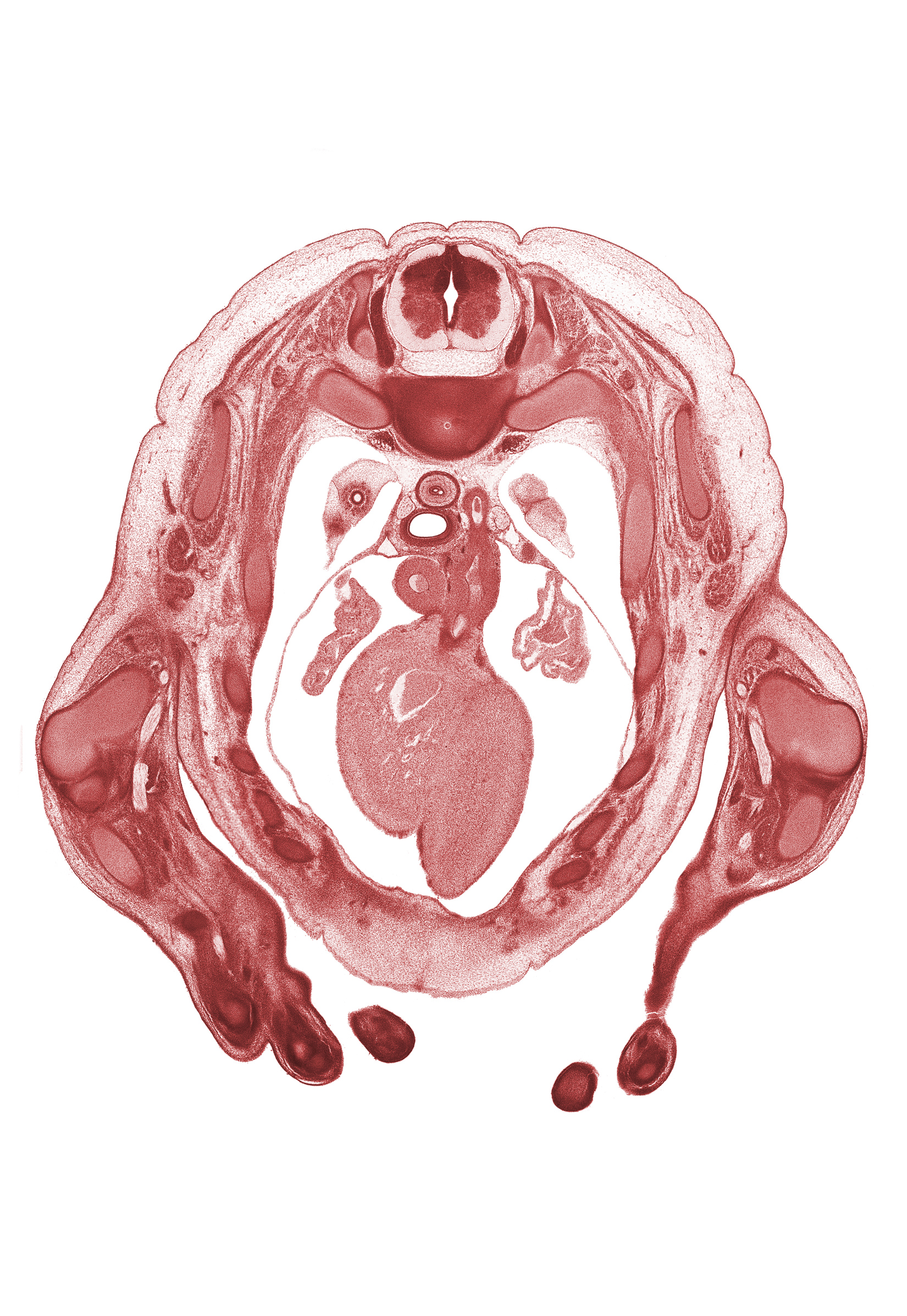 T-2 spinal ganglion, T-3 / T-4 intervertebral disc, auricle of left atrium, auricle of right atrium, ductus arteriosus, interventricular sulcus, left ventricle, rhomboid major muscle, rib 3, right ventricle, subarachnoid space, superior vena cava, sympathetic trunk, ulna, ulnar nerve