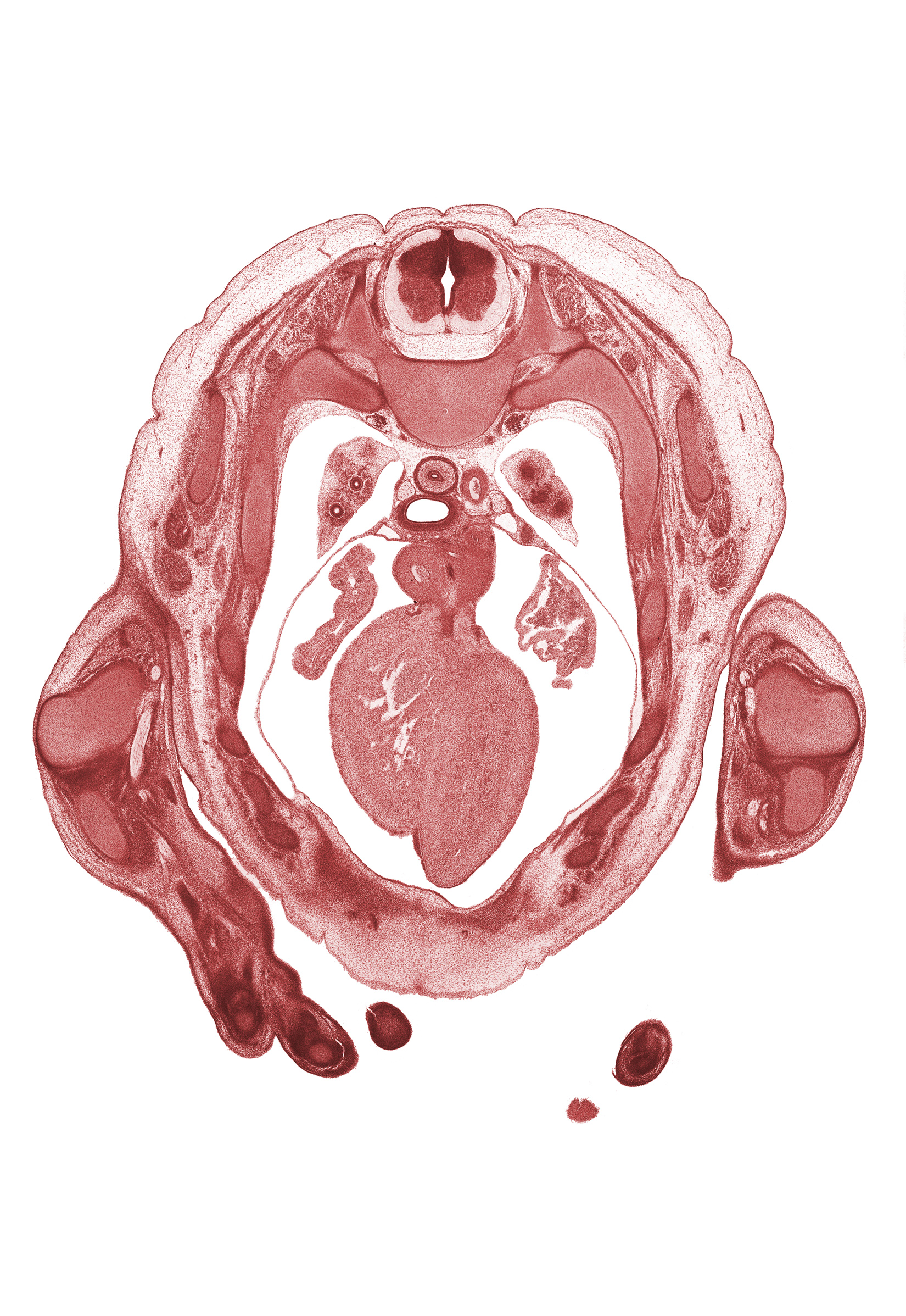 T-2 / T-3 interganglion region, ascending aorta, auricle of left atrium, auricle of right atrium, central canal, heart prominence, interventricular sulcus, left vagus nerve (CN X), left ventricle, neural arch, rib 3, rib 4, rib 5, rib 6, rib 7, right pulmonary artery, right vagus nerve (CN X), sulcus limitans, trabecular part of right ventricle, tracheal bifurcation, ulna, upper lobe of left lung