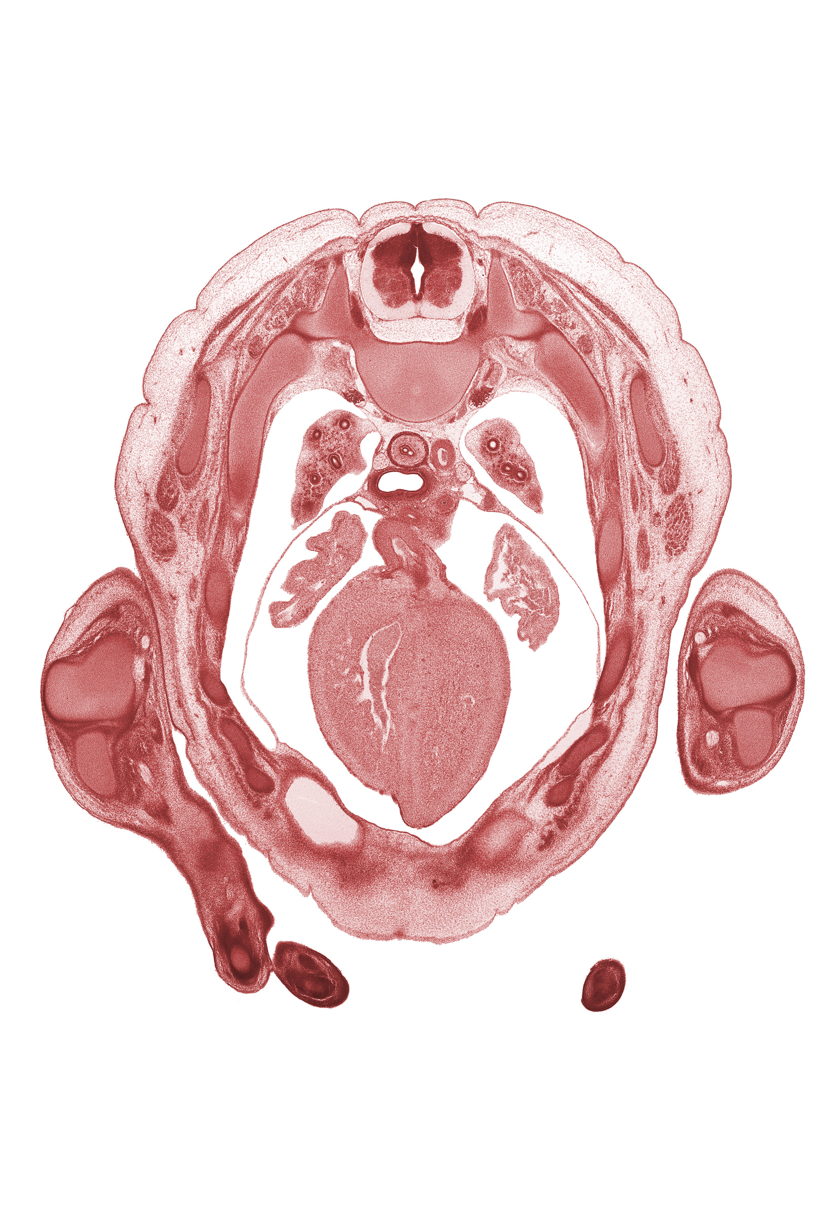 T-3 spinal ganglion, auricle of left atrium, auricle of right atrium, central tendon of diaphragm, cephalic edge of peritoneal cavity, left hand, left ventricle, neural arch, pericardial cavity, right vagus nerve (CN X), sympathetic trunk, trabecular part of right ventricle, tracheal bifurcation, transverse process, ulna, ulnar nerve, upper lobe of left lung, upper lobe of right lung