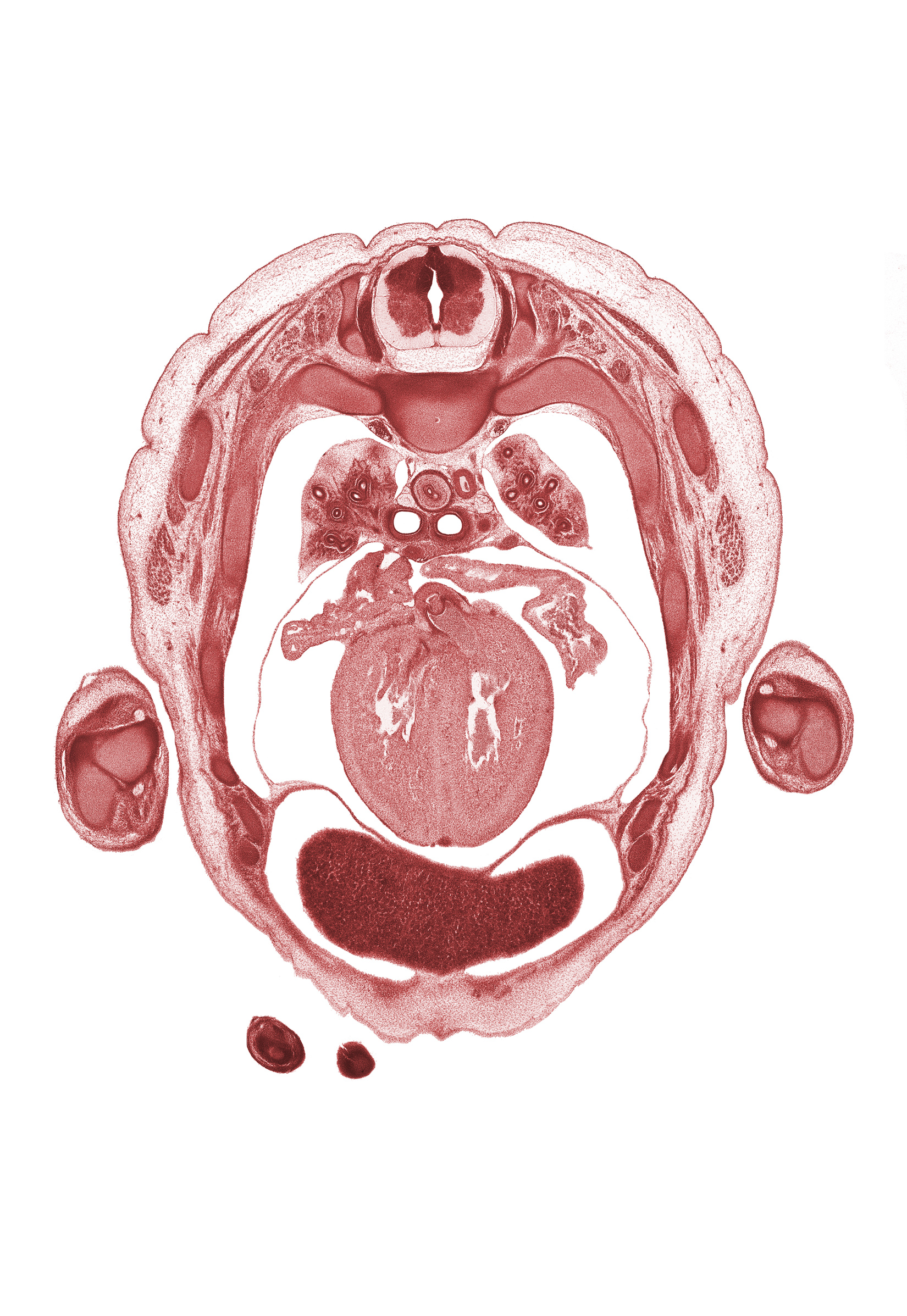 T-3 spinal ganglion, aortic semilunar valve, azygos vein, central tendon of diaphragm, digits (fingers), esophagus, left lobe of liver, left ventricle, neural arch, osteogenic layer, pericardial cavity, peritoneal cavity, pleural cavity, pleural recess, primary bronchus, rib 4, rib 5, right lobe of liver, right ventricle, subarachnoid space, sulcus limitans, superior hemi-azygos vein, sympathetic trunk, ulnar nerve, upper lobe of left lung