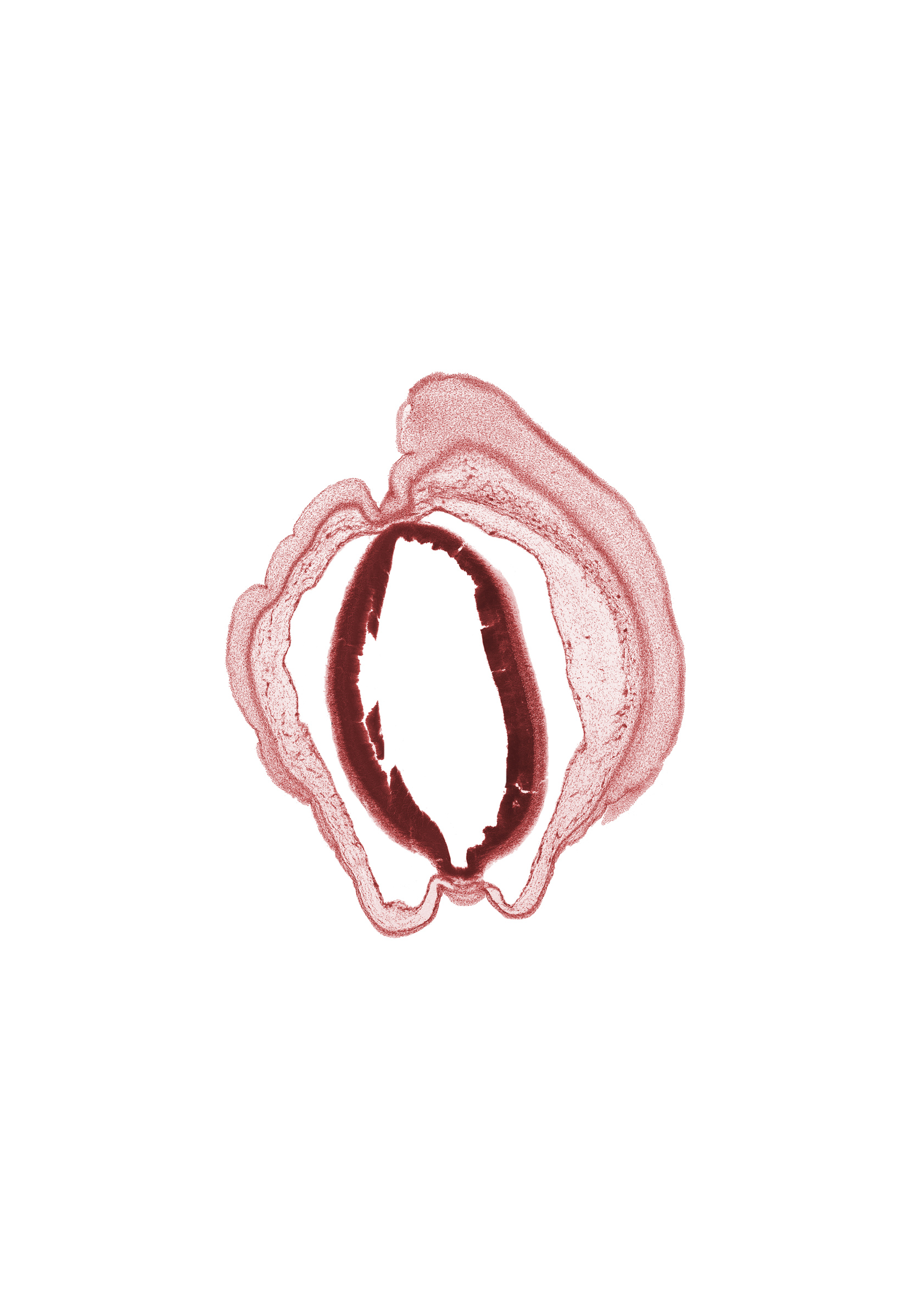 alar plate of mesencephalon (longitudinal section), artifact fracture(s), artifact space(s), cerebral aqueduct (longitudinal section), head mesenchyme, osteogenic layer, roof plate of mesencephalon, subarachnoid space, surface ectoderm