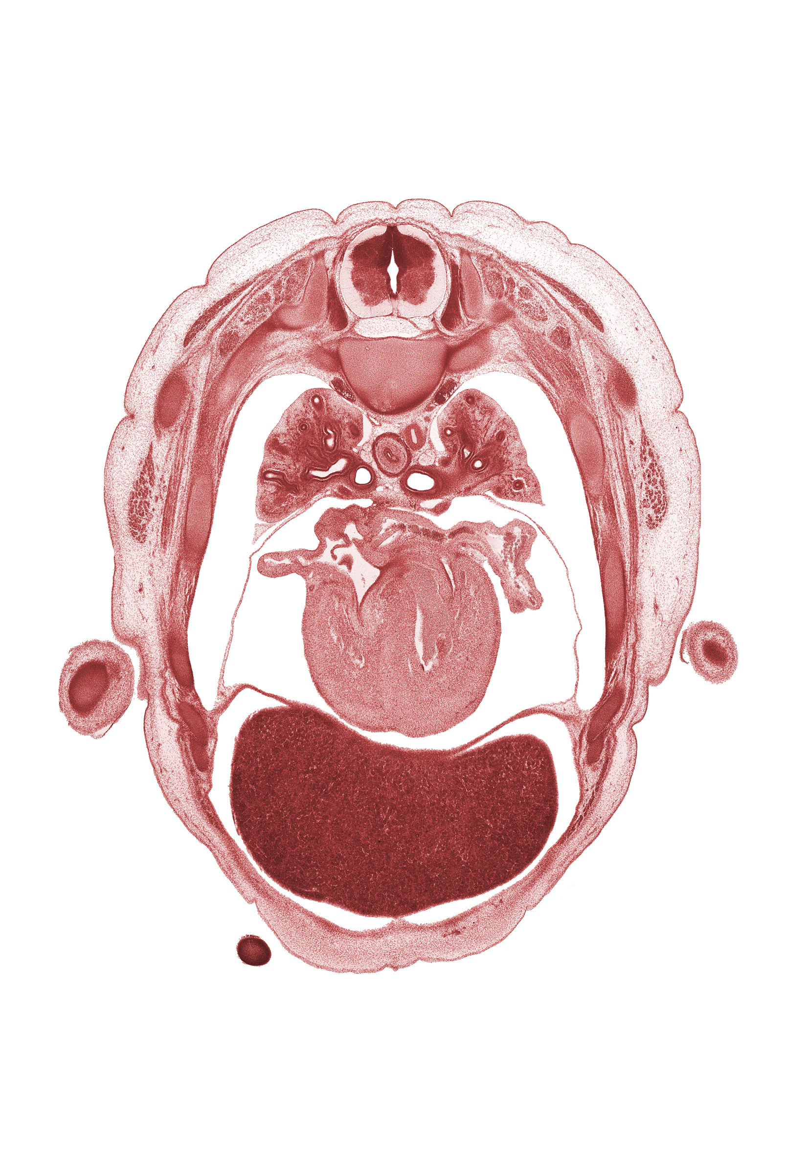 T-4 spinal ganglion, apex of heart, auricle of left atrium, digit tip, head of rib 5, left atrioventricular (mitral) valve, olecranon process of ulna, pericardial cavity, peritoneal cavity, pleural cavity, primary bronchus, right atrioventricular (tricuspid) valve, right phrenic nerve, sympathetic trunk, upper lobe of left lung, upper lobe of right lung
