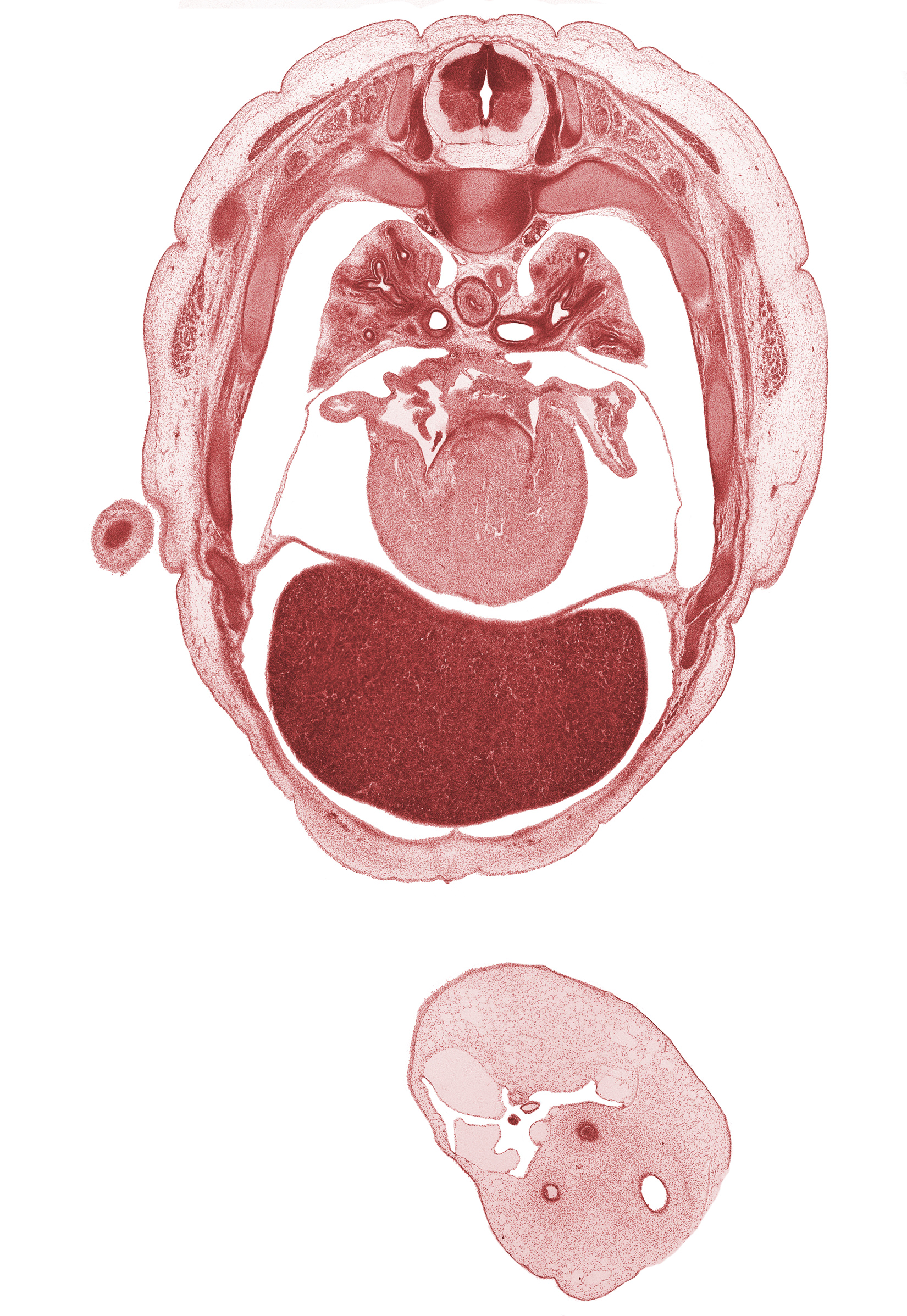 T-4 spinal ganglion, allantois, amnion on surface of umbilical cord, aorta, artifact disruption of amnion, caudal edge of elbow, latissimus dorsi muscle, left atrioventricular canal, left atrium, left lobe of liver, left umbilical artery, left ventricle, liver prominence, mucoid connective tissue, rib 5, rib 6, rib 7, right atrioventricular canal, right lobe of liver, right umbilical artery, right ventricle, scapula, umbilical coelom, umbilical vein, upper lobe of left lung, upper lobe of right lung