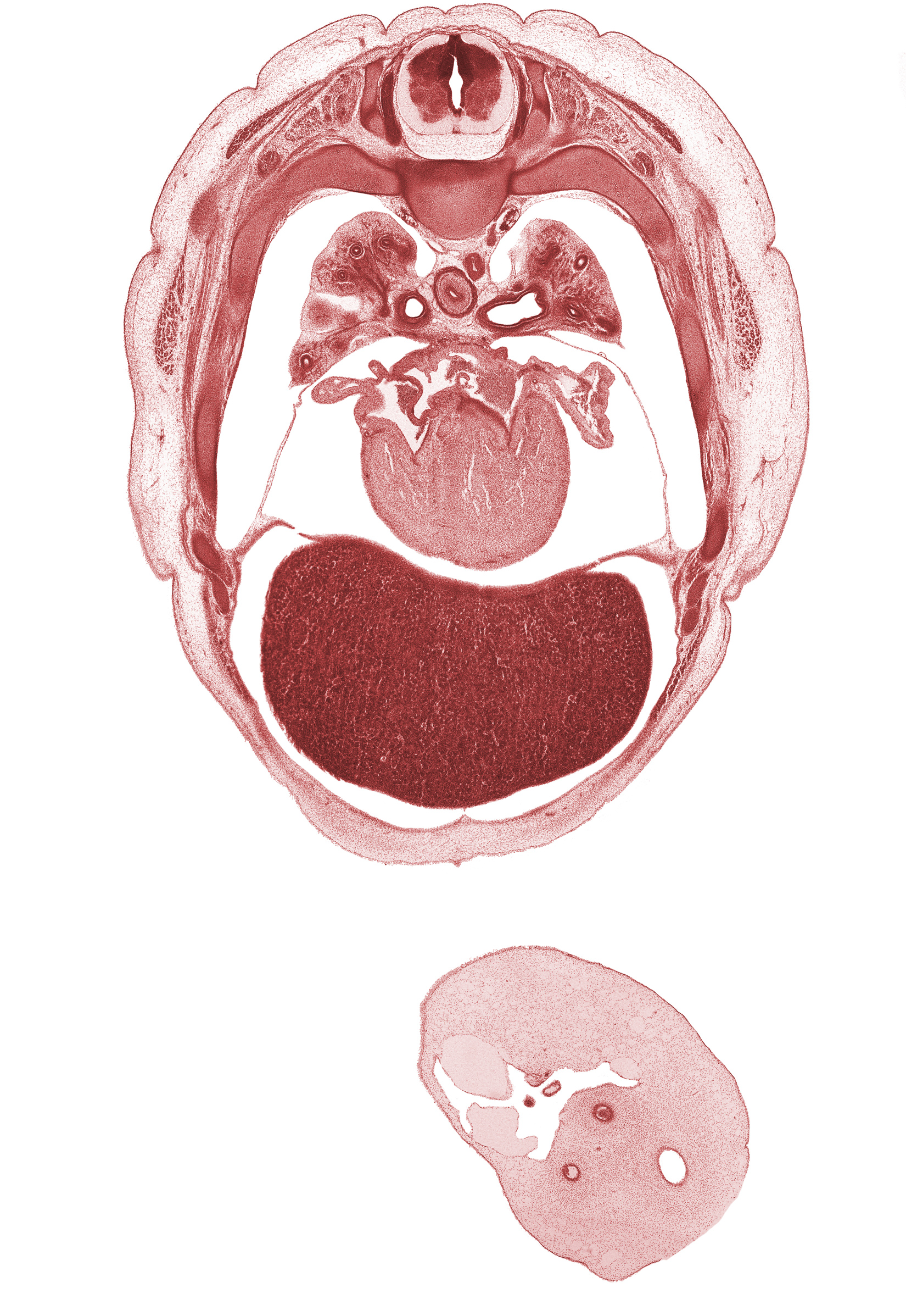 T-4 spinal ganglion, amnion on surface of umbilical cord, auricle of left atrium, central tendon of diaphragm, horizontal fissure, left atrium, left ventricle, liver prominence, middle lobe of right lung, pericardial cavity, pericardial sac, peritoneal cavity, pleural cavity, primary bronchus, rib 5, right atrium, right ventricle, trapezius muscle, umbilical coelom, umbilical cord, umbilical vesicle stalk, upper lobe of right lung, upper secondary bronchus