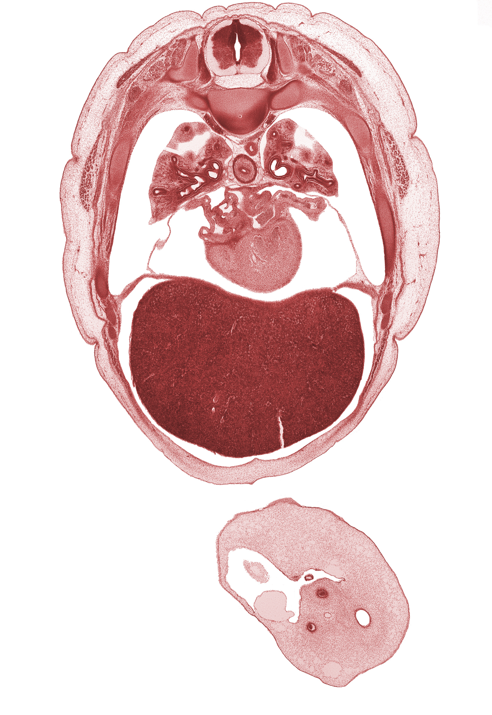 T-5 spinal ganglion, artifact separation(s), caudal edge of scapula, head of rib 6, left lobe of liver, left upper pulmonary vein, lower lobe of left lung, middle lobe of right lung, neural arch, oblique fissure, pericardial cavity, pleural recess, right lobe of liver, secondary interatrial septum (septum secundum), trapezius muscle, umbilical coelom, umbilical cord, umbilical vesicle stalk, upper lobe of left lung