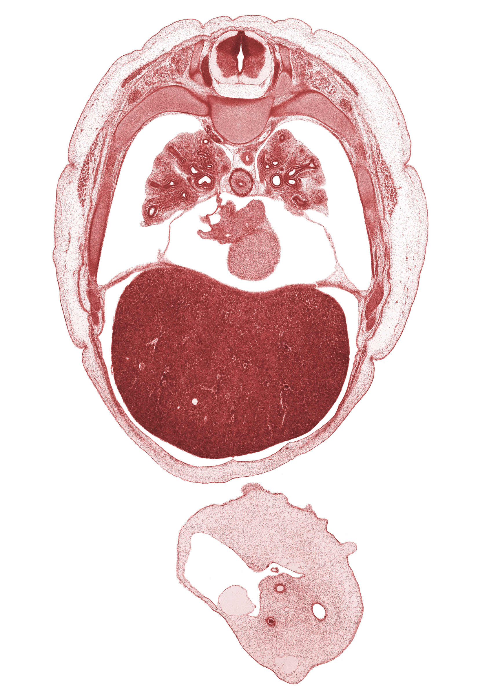 T-5 spinal ganglion, aorta, left ventricle, lingula of upper lobe of left lung, lower lobe of left lung, lower lobe of right lung, lower secondary bronchus, middle lobe of right lung, oblique fissure, pericardial cavity, peritoneal cavity, rib 6, rib 7, rib 8, rib 9, right atrium, umbilical coelom, umbilical vesicle stalk