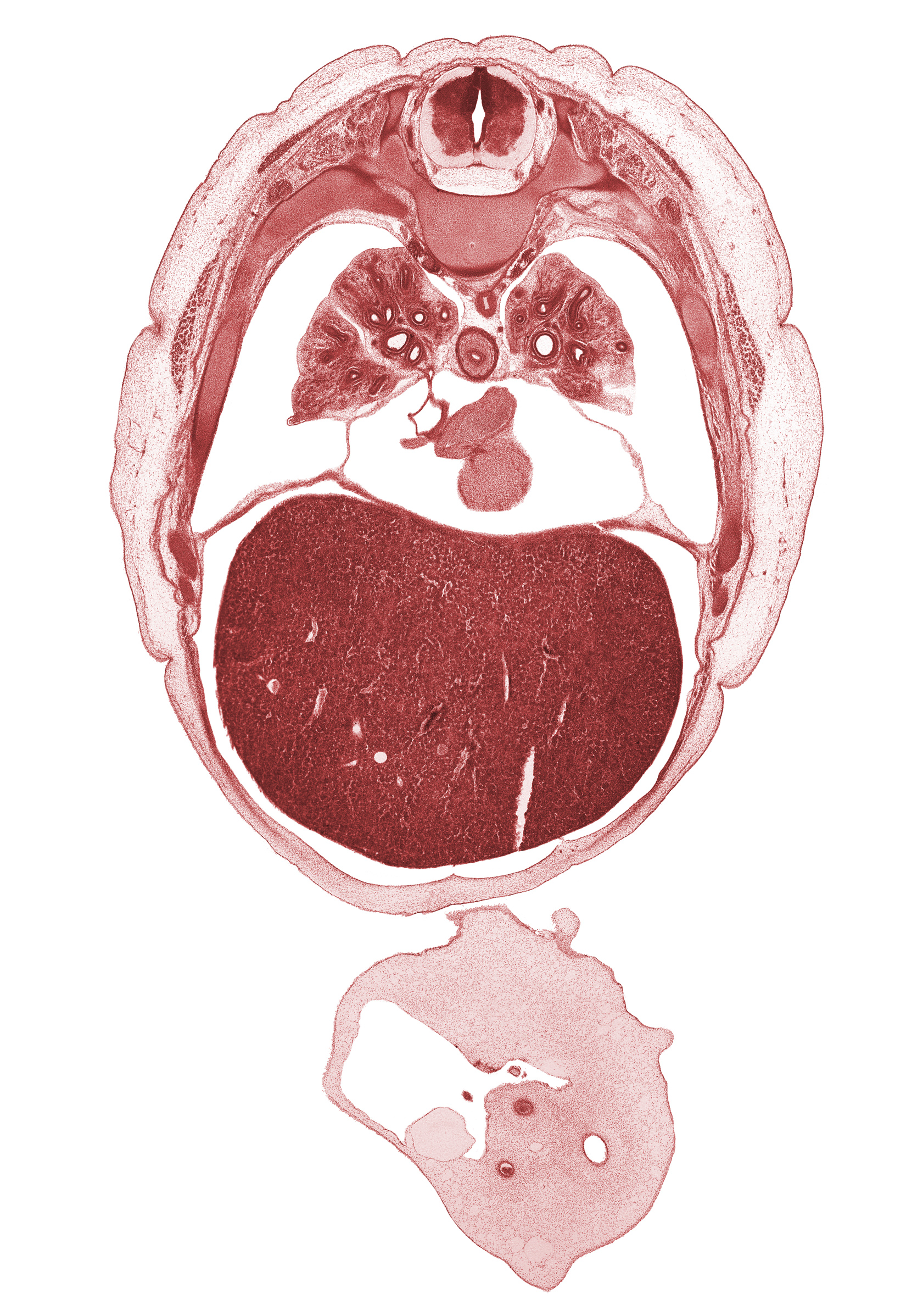 L-5 ventral primary ramus, T-5 / T-6 interganglion region, T-6 intercostal nerve, allantois, caudal edge of lingula of upper lobe of left lung, external abdominal oblique muscle, inferior vena cava, left umbilical artery, left ventricle, liver prominence, lower lobe of right lung, middle lobe of right lung, oblique fissure, peritoneal cavity, rib 7, rib 8, rib 9, right atrium, right lower pulmonary vein, right umbilical artery, sympathetic trunk, umbilical coelom, umbilical vein