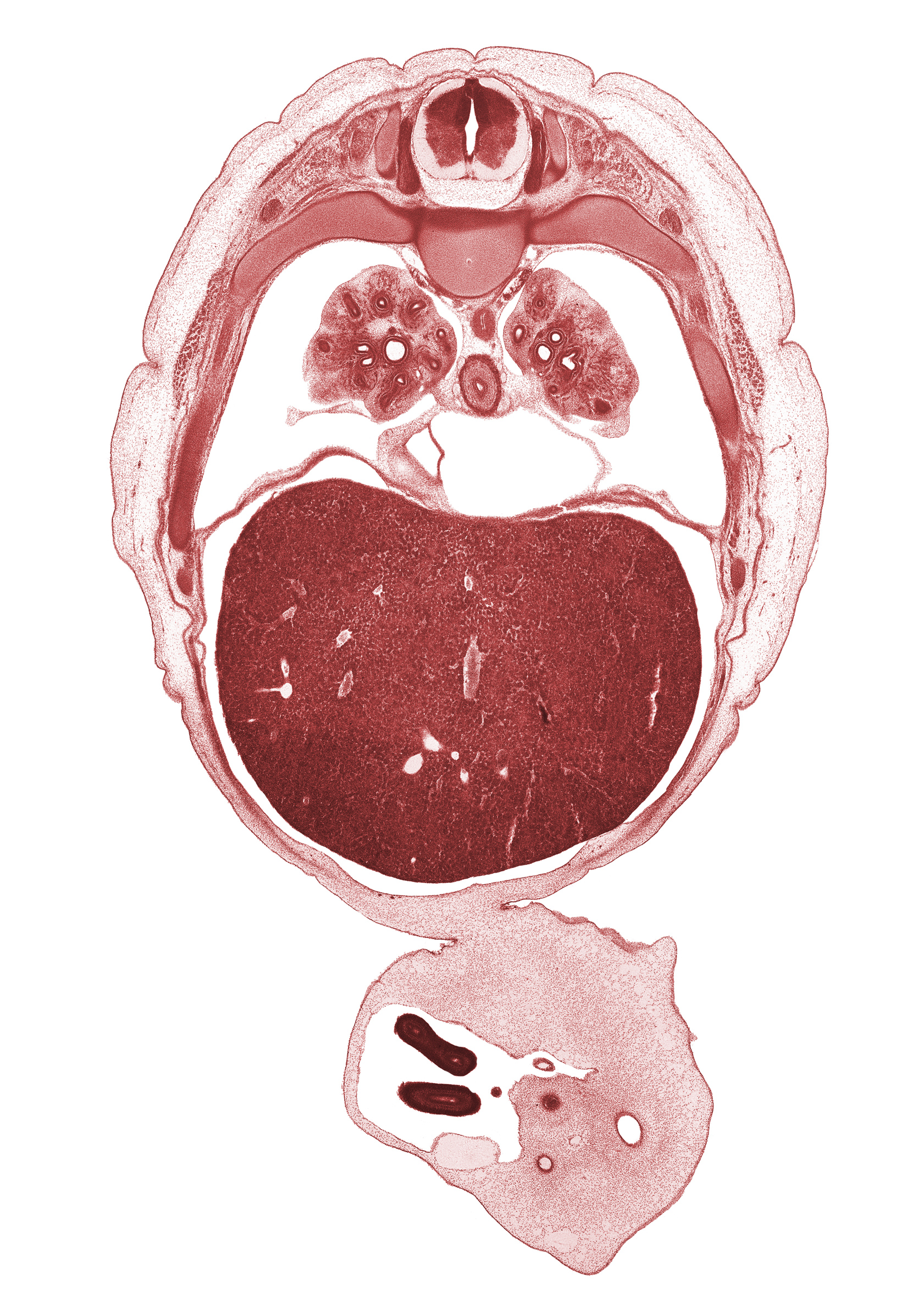 T-6 spinal ganglion, alar plate(s), allantois, basal plate, central tendon of diaphragm, distal limb of herniated midgut, floor plate, inferior vena cava, latissimus dorsi muscle, left lobe of liver, left umbilical artery, left vagus nerve (CN X), lower lobe of right lung, rib 7, rib 8, right lobe of liver, right umbilical artery, roof plate, sulcus limitans, umbilical coelom, umbilical vein, umbilical vesicle stalk