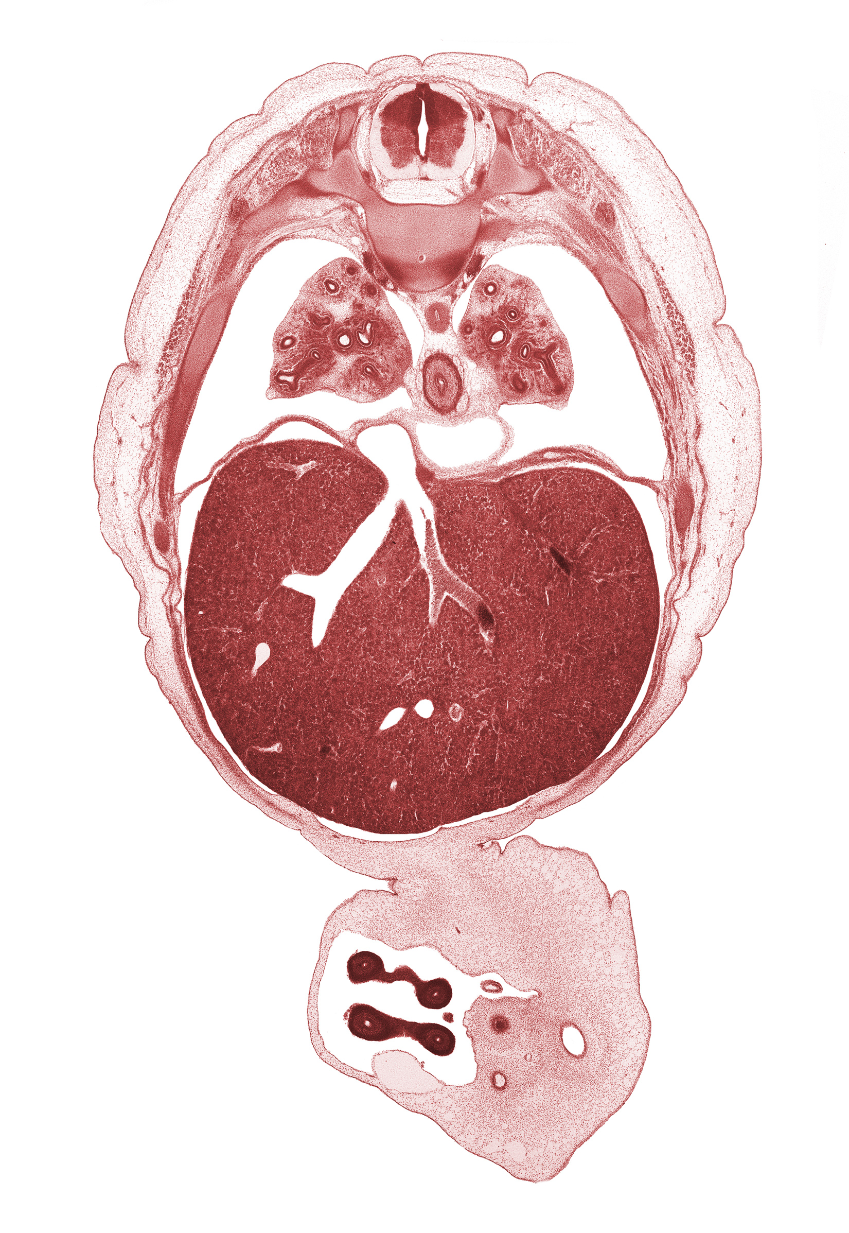 T-6 / T-7 interganglion region, allantois, aorta, caudal edge of pericardial cavity, distal limb of herniated midgut, efferent hepatic vein, esophagus, junction of hepatic veins and inferior vena cava, left lobe of liver, left umbilical artery, left vagus nerve (CN X), lower lobe of right lung, proximal limb of herniated midgut, rib 8, rib 9, right lobe of liver, right umbilical artery, right vagus nerve (CN X), sympathetic trunk, umbilical coelom, umbilical vein, umbilical vesicle stalk