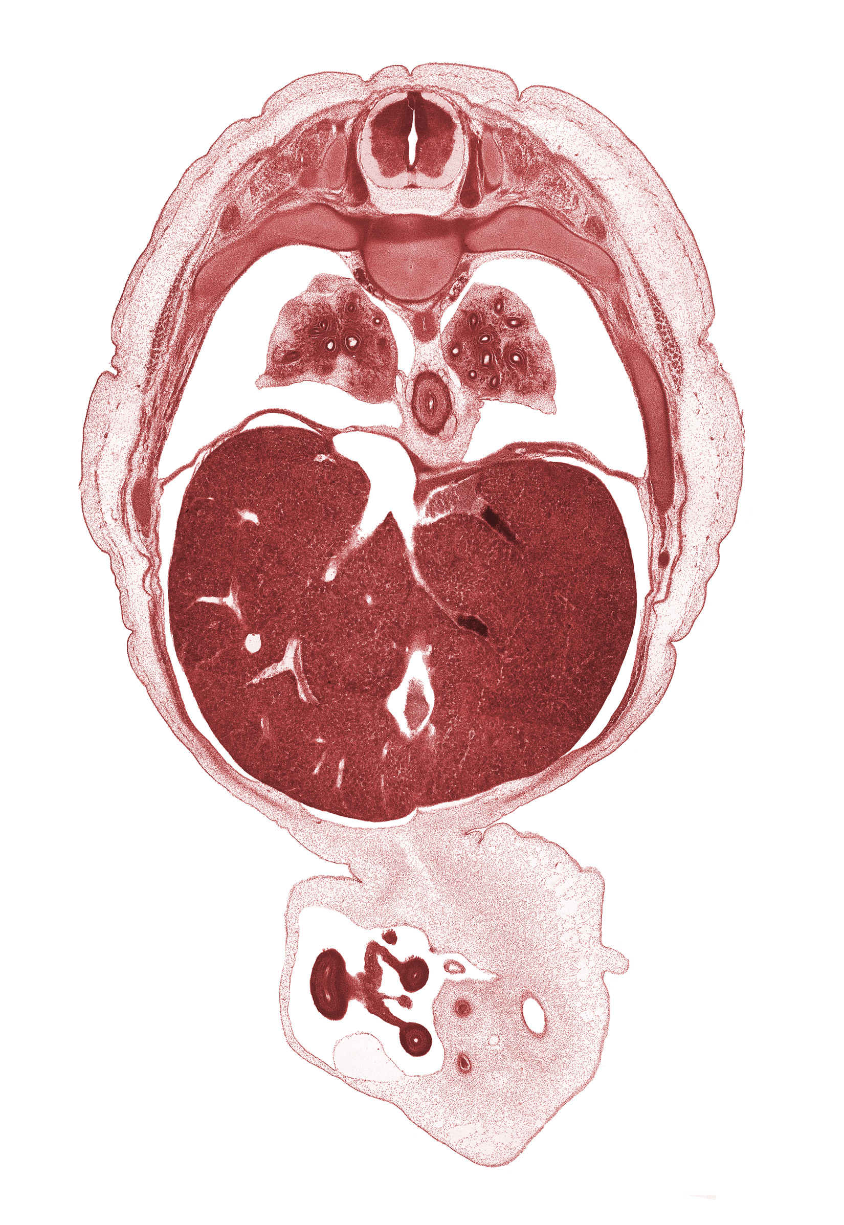 T-7 / T-8 intervertebral disc, T-7 spinal ganglion, diaphragm, distal limb of herniated midgut, edge of ductus venosus, efferent hepatic vein, lower lobe of left lung, lower lobe of right lung, mesentery of herniated midgut, midpoint of herniated midgut, pleural recess, proximal limb of herniated midgut, rib 10, rib 8, rib 9, right lobe of liver, umbilical vesicle stalk