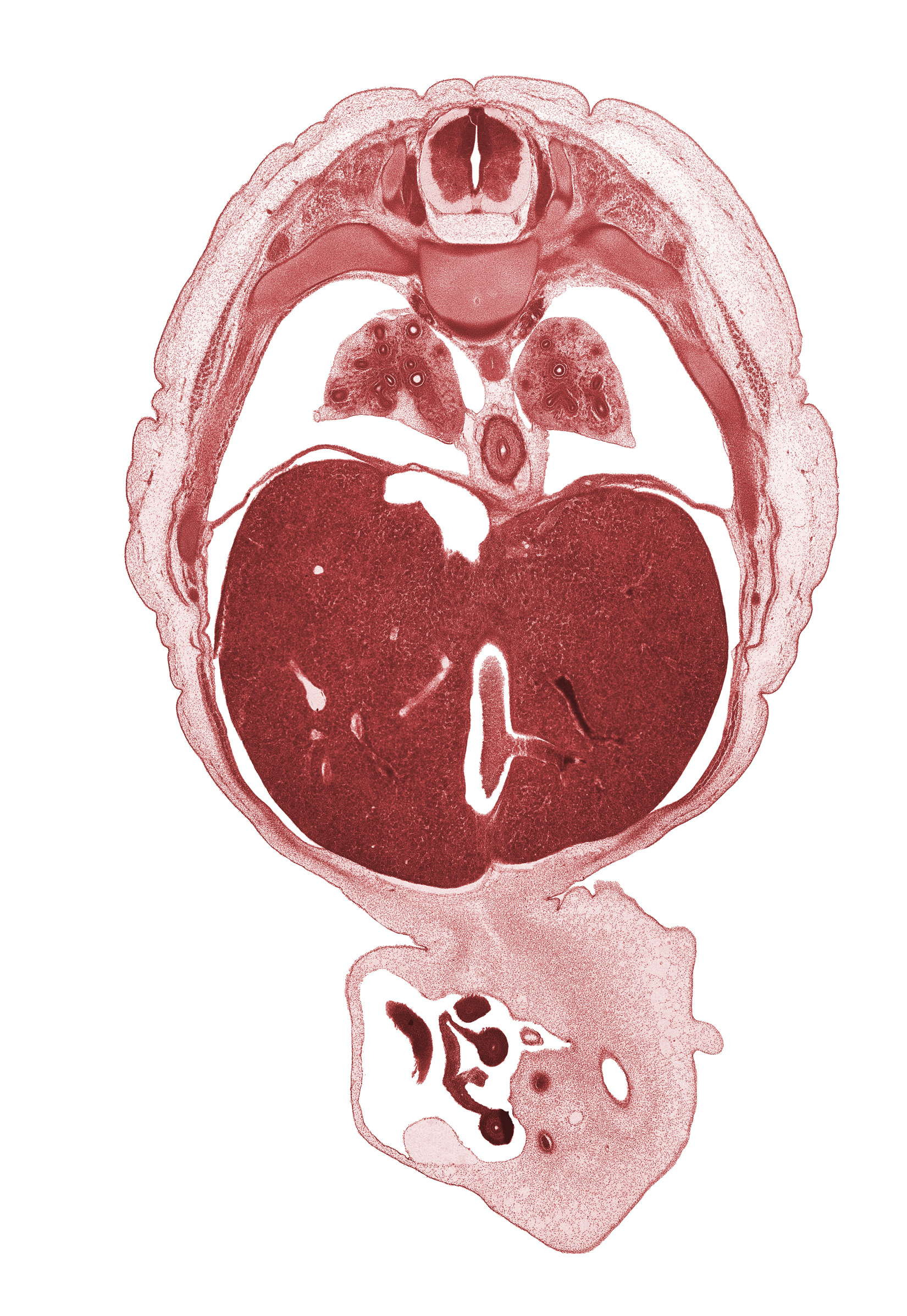 T-7 spinal ganglion, allantois, aorta, distal limb of herniated midgut, dorsal meso-esophagus, ductus venosus, esophagus, inferior vena cava, left lobe of liver, left umbilical artery, lower lobe of left lung, lower lobe of right lung, proximal limb of herniated midgut, rib 8, rib 9, right lobe of liver, right umbilical artery, sympathetic trunk, umbilical vein, umbilical vesicle stalk