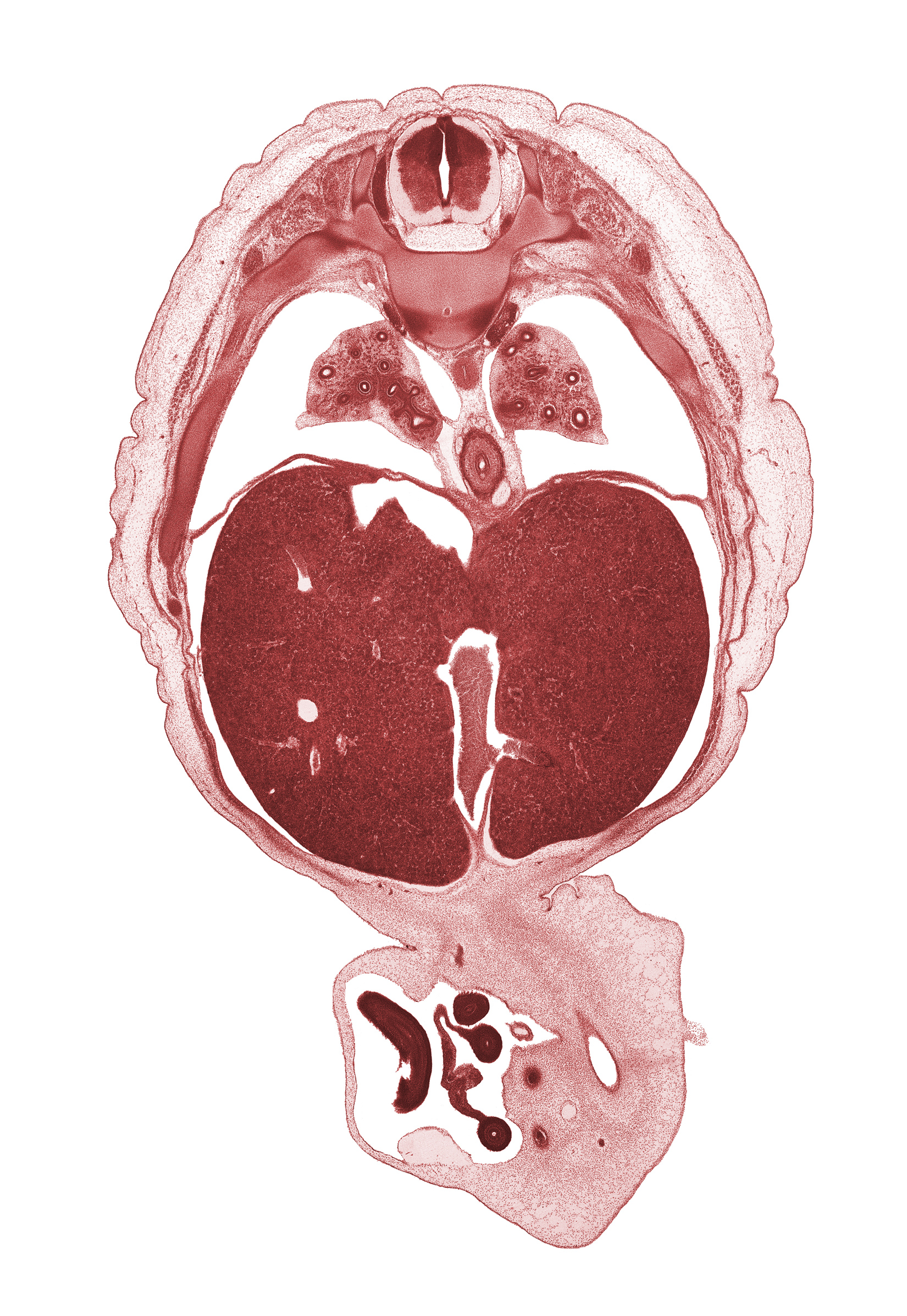 T-7 / T-8 interganglion region, afferent hepatic vein, aorta, central canal, diaphragm, distal limb of herniated midgut, ductus venosus, esophagus, left lobe of liver, lower lobe of left lung, lower lobe of right lung, neural arch, pleural recess, proximal limb of herniated midgut, rib 9, right lobe of liver, sympathetic trunk, umbilical vesicle stalk