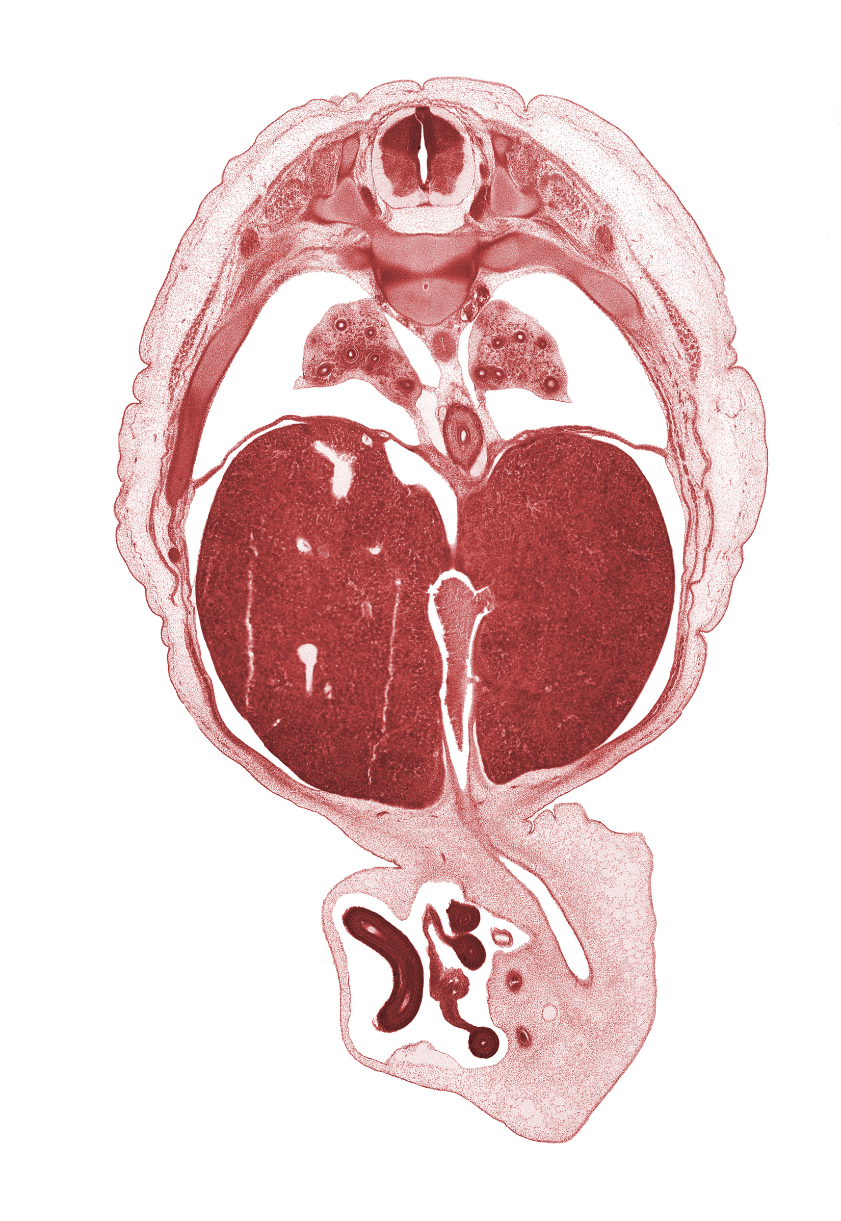 T-8 / T-9 intervertebral disc, T-8 spinal ganglion, allantois, artifact fracture(s), ductus venosus, left umbilical artery, lower lobe of left lung, lower lobe of right lung, notochord, pleural cavity, proximal limb of herniated midgut, pulmonary ligament, rib 9, right umbilical artery, umbilical vein, umbilical vesicle stalk