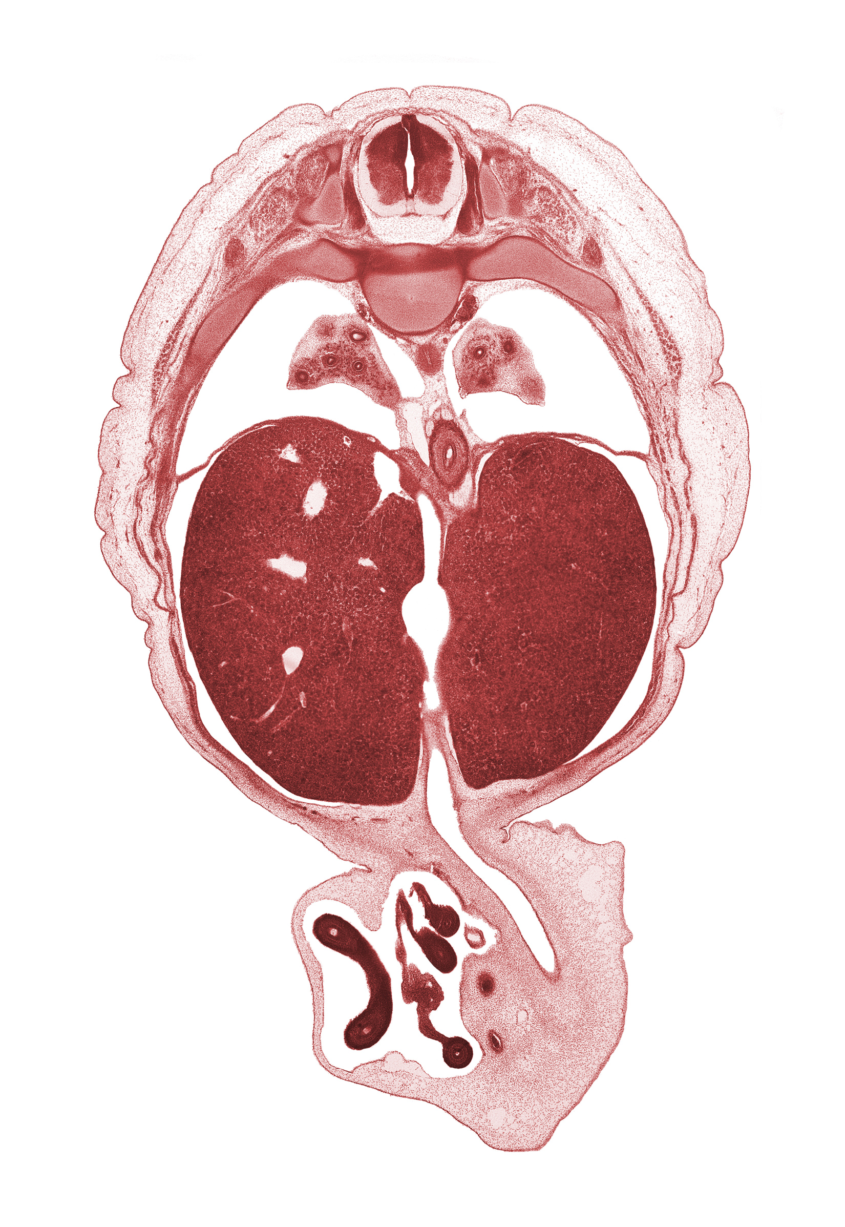 T-8 spinal ganglion, T-8 spinal nerve, anterior gastric nerve (CN X), aorta, central canal, distal limb of herniated midgut, ductus venosus, esophageal hiatus, inferior vena cava, intermediate zone, left lobe of liver, lower hemi-azygos vein, lower lobe of left lung, lower lobe of right lung, marginal zone, neural arch, peritoneal cavity, posterior gastric nerve (CN X), proximal limb of herniated midgut, rib 9, right lobe of liver, umbilical vein, umbilical vesicle stalk, ventricular zone