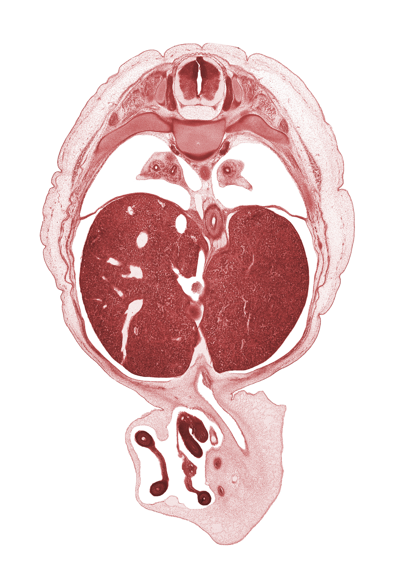 T-8 spinal ganglion, afferent hepatic vein, aorta, distal limb of herniated midgut, esophagus lumen, iliocostalis muscle, left lobe of liver, longissimus muscle, lower lobe of left lung, lower lobe of right lung, proximal limb of herniated midgut, pylorus of stomach, rib 9, right lobe of liver, spinalis muscle, umbilical vein, umbilical vesicle stalk