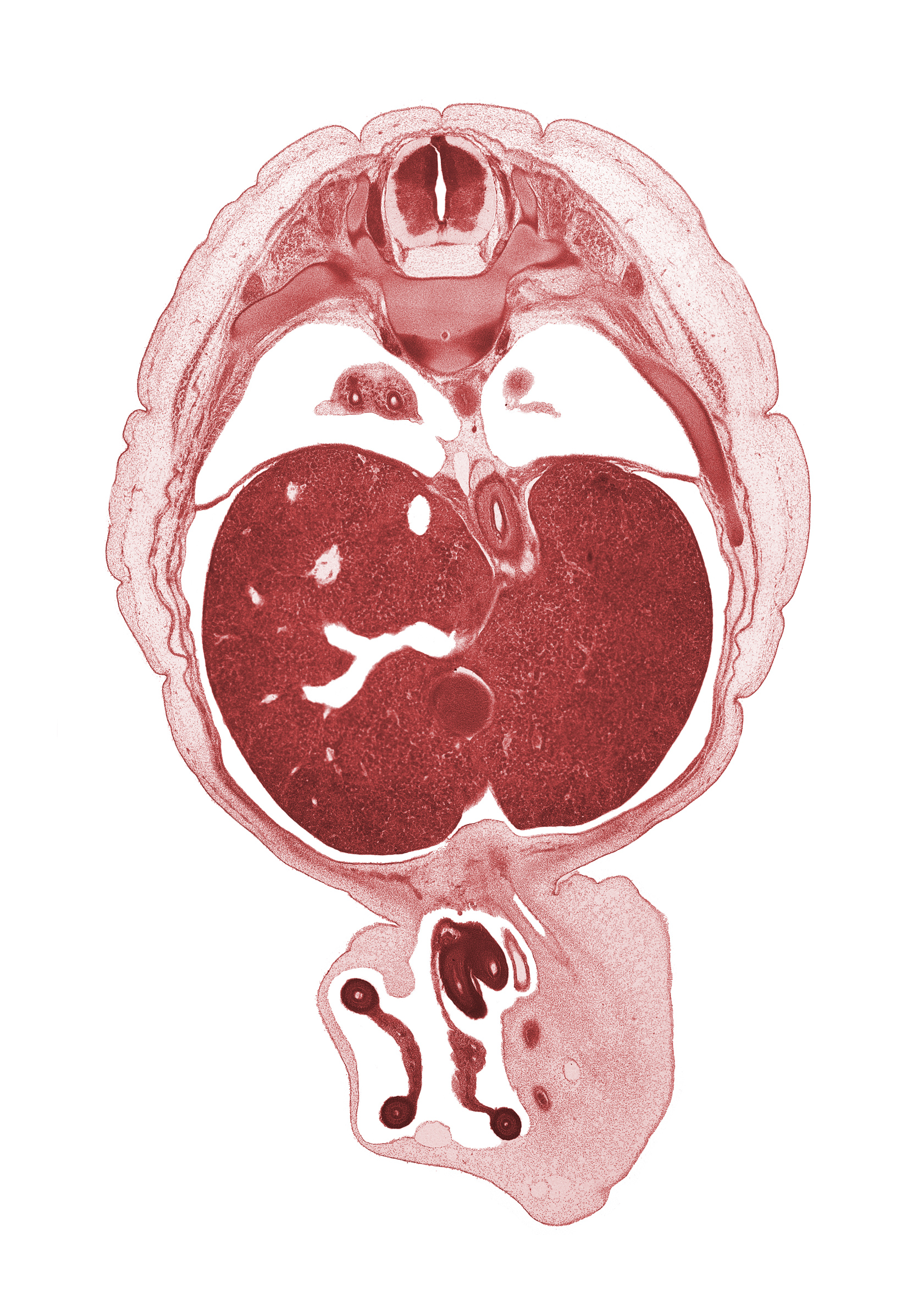 T-9 spinal ganglion, afferent hepatic vein, allantois, anterior gastric nerve (CN X), aorta, bronchogenic mesoderm, caudal edge of left lung, caudal edge of umbilical vein, cephalic edge of pyloric antrum of stomach, distal limb of herniated midgut, esophagus, left umbilical artery, lesser sac (omental bursa), pleural cavity, pleural recess, posterior gastric nerve (CN X), proximal limb of herniated midgut, rib 10, right lobe of liver, right umbilical artery, umbilical cord