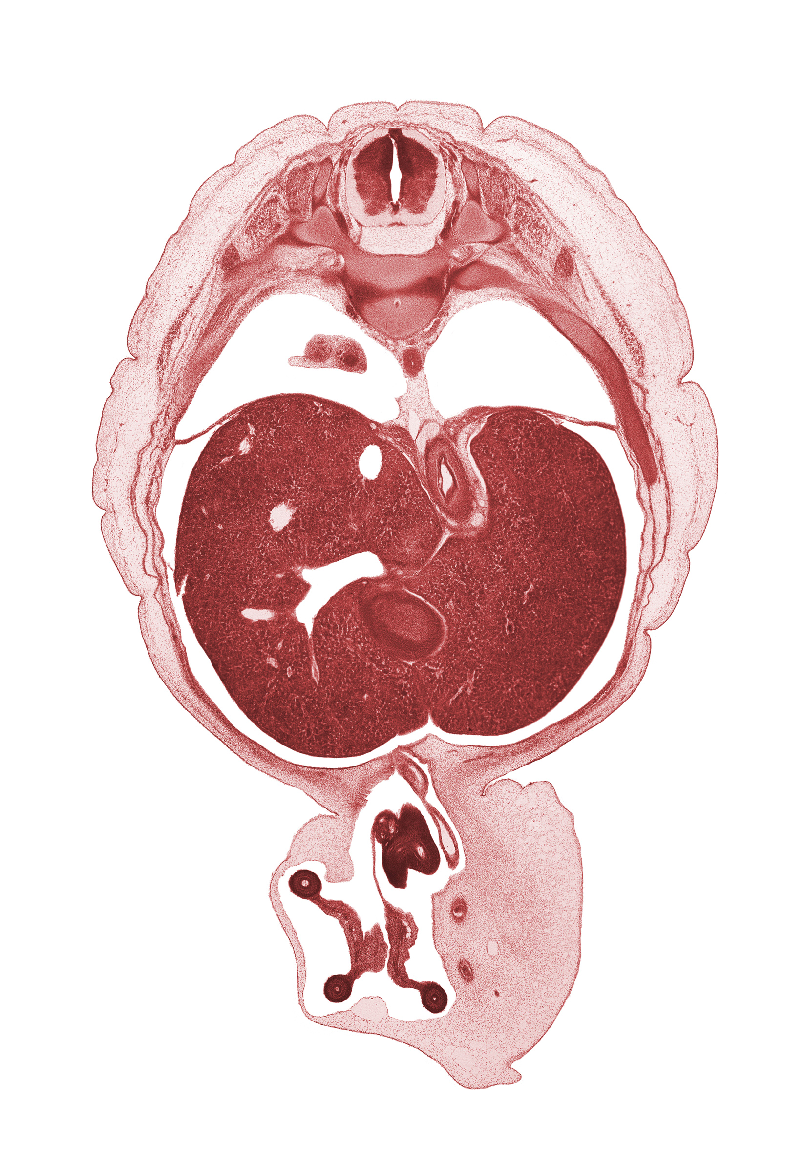 T-9 / T-10 intervertebral disc, T-9 spinal ganglion, T-9 spinal nerve, afferent hepatic vein, allantois, amnion on surface of umbilical cord, aorta, appendix, distal limb of herniated midgut, esophagus lumen, left lobe of liver, lesser sac (omental bursa), lower lobe of right lung, mediastinum, notochord, peritoneal cavity, proximal limb of herniated midgut, rib 10, right lobe of liver, surface ectoderm, umbilical coelom