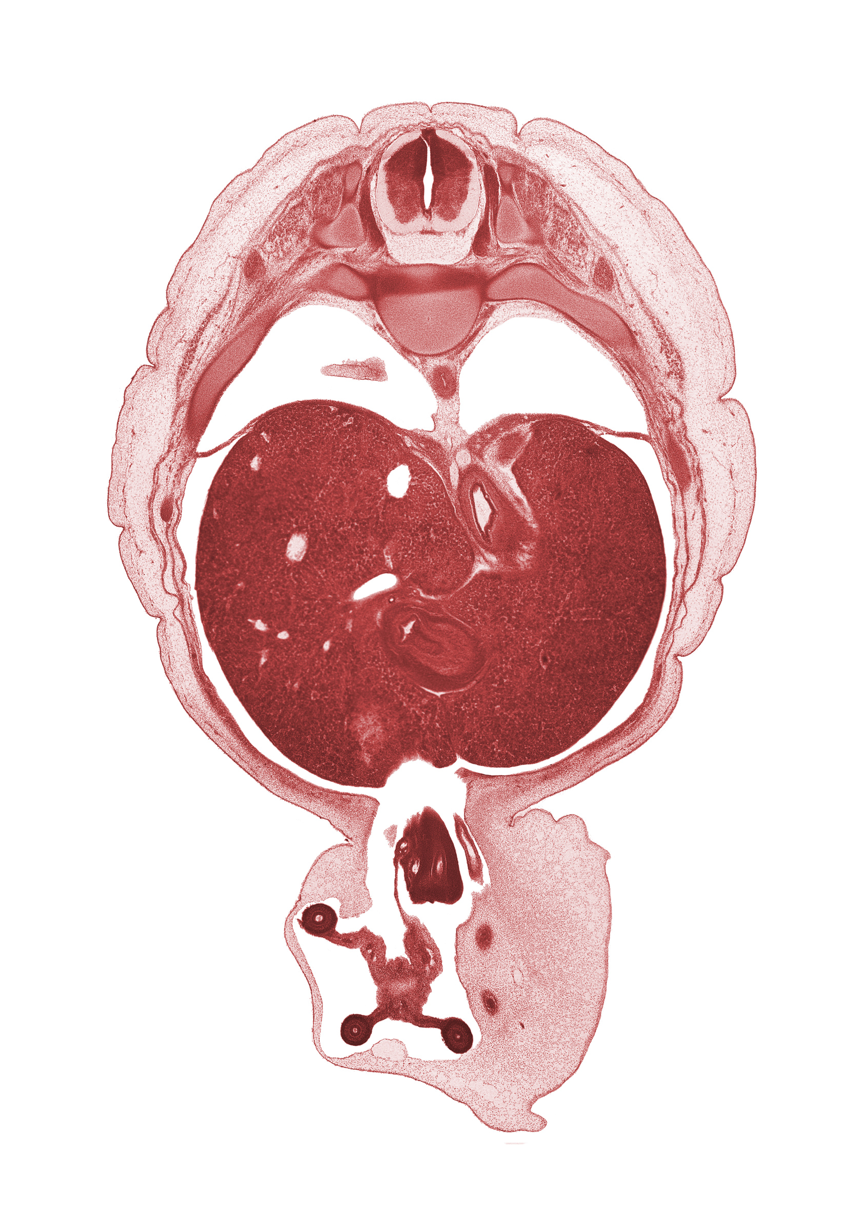 T-9 intercostal nerve, T-9 spinal ganglion, appendix, caudate lobe of liver, central canal, cephalic edge of suprarenal gland cortex, distal limb of herniated midgut, duodenum (first part), iliocostalis muscle, junction of esophagus and stomach, junction of peritoneal cavity and umbilical coelom, longissimus muscle, lung, right, proximal limb of herniated midgut, rib 10, spinalis muscle, umbilical vesicle stalk, wall of pyloric antrum of stomach