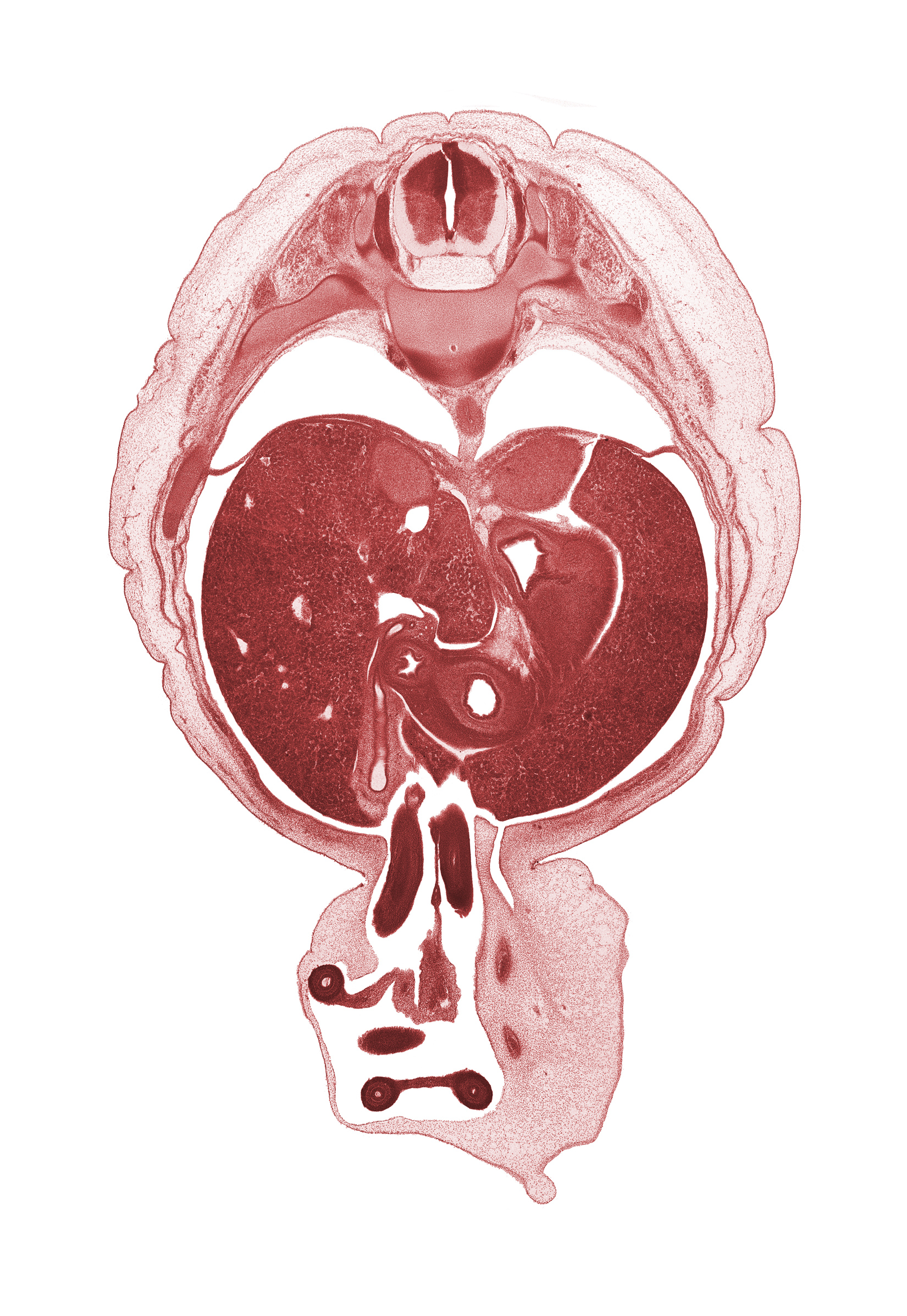 T-10 spinal ganglion, aorta, caudate lobe of liver, cystic duct, distal limb of herniated midgut, gall bladder, head of pancreas, left lobe of liver, lesser curvature of stomach, pleural cavity, pleural recess, proximal limb of herniated midgut, pyloric antrum of stomach, right lobe of liver, suprarenal gland cortex, umbilical coelom, umbilical cord, umbilical vesicle stalk