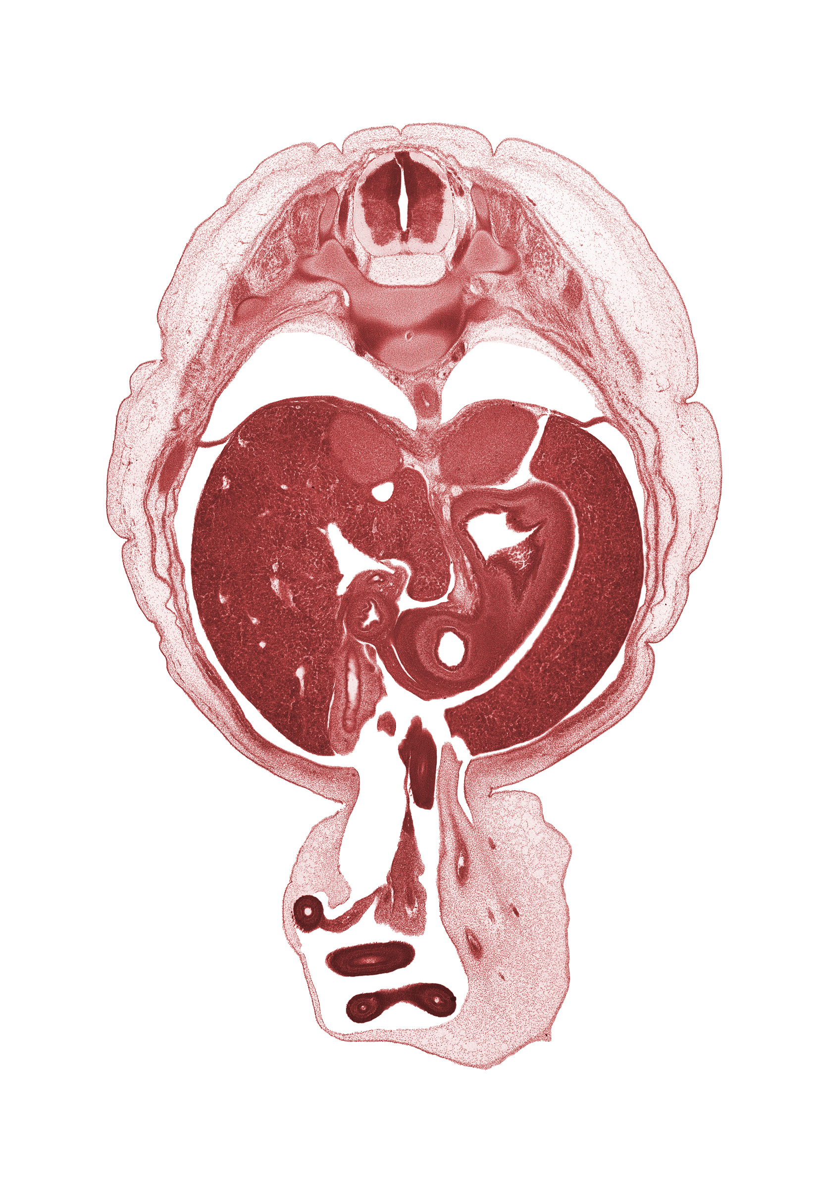 T-10 spinal ganglion, aorta, caudate lobe of liver, distal limb of herniated midgut, duodenum, gall bladder, head of rib 11, left umbilical artery, lesser curvature of stomach, lesser sac (omental bursa), mesentery, proximal limb of herniated midgut, pyloric antrum of stomach, right umbilical artery, sympathetic trunk