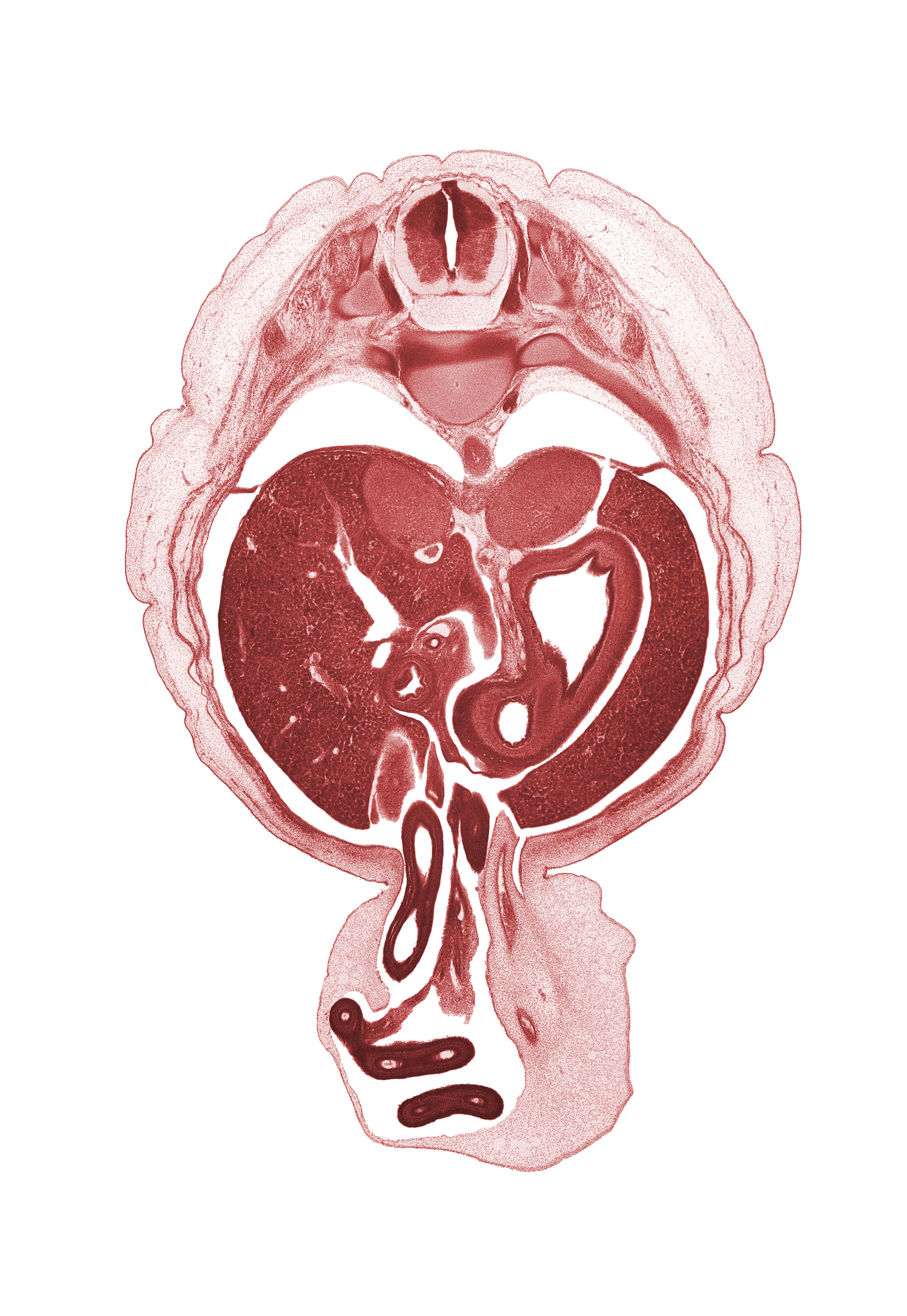 T-10 / T-11 intervertebral disc, T-10 spinal ganglion, T-10 spinal nerve, allantois, aorta, bile duct, body of stomach, distal limb of midgut, duodenum, fundus of stomach, hepatic artery, hepatic portal vein, intermediate zone, latissimus dorsi muscle, left umbilical artery, marginal zone, pleural recess, proximal limb of herniated midgut, pyloric antrum of stomach, rib 11, right umbilical artery, sympathetic trunk, umbilical cord, ventricular zone