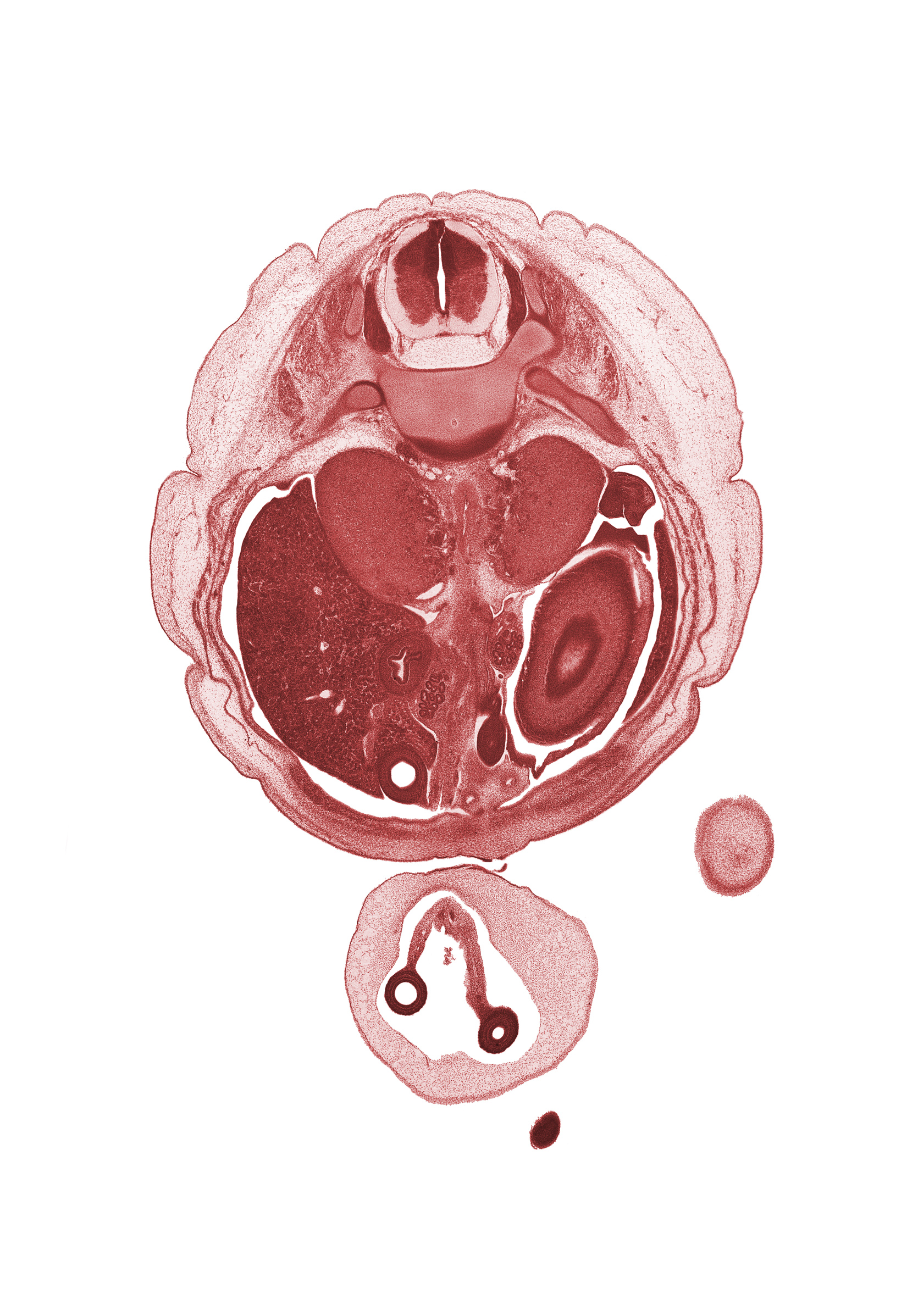 T-11 spinal ganglion, allantois, amnion on surface of umbilical cord, aorta, body of dorsal pancreas, caudal edge of left lobe of liver, cephalic edge of left foot, distal part of duodenum, external abdominal oblique muscle, head of ventral pancreas, iliocostalis muscle, internal abdominal oblique muscle, left umbilical artery, longissimus muscle, lower limb, mesonephros, origin of superior mesenteric artery, proximal limb of herniated midgut, rectus abdominis muscle, rib 12, right umbilical artery, spinalis muscle, spleen, subarachnoid space, transversus abdominis muscle, umbilical coelom