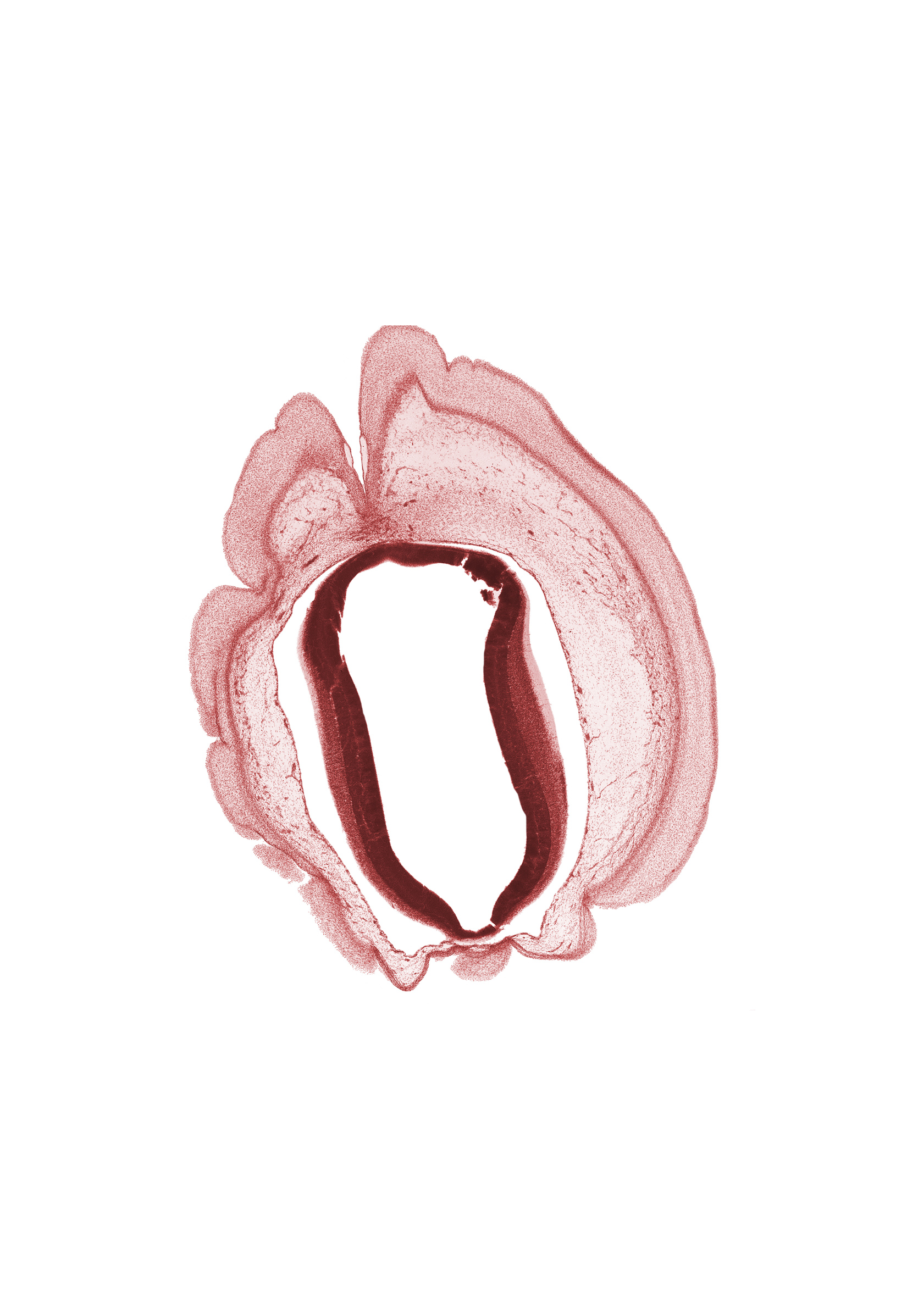 alar plate of mesencephalon, artifact space(s), cerebral aqueduct (mesocoele), head mesenchyme, osteogenic layer, roof plate of mesencephalon, subarachnoid space, surface ectoderm