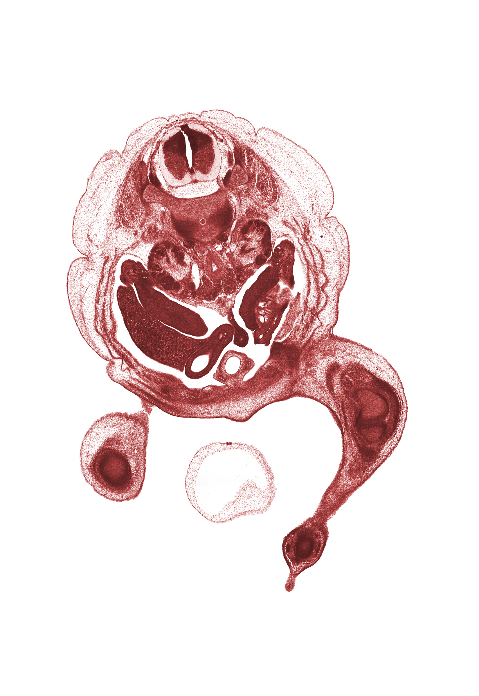 L-1 spinal nerve, T-12 / L-1 interganglion region, aorta, central canal, distal part of duodenum, external abdominal oblique muscle, hindgut, intermediate zone, internal abdominal oblique muscle, marginal zone, medial condyle of femur, medial condyle of tibia, missing section of herniated midgut (artifact), notochord, ovary, paramesonephric duct, right umbilical artery, sympathetic trunk, transversus abdominis muscle, umbilical cord, urinary bladder, ventricular zone