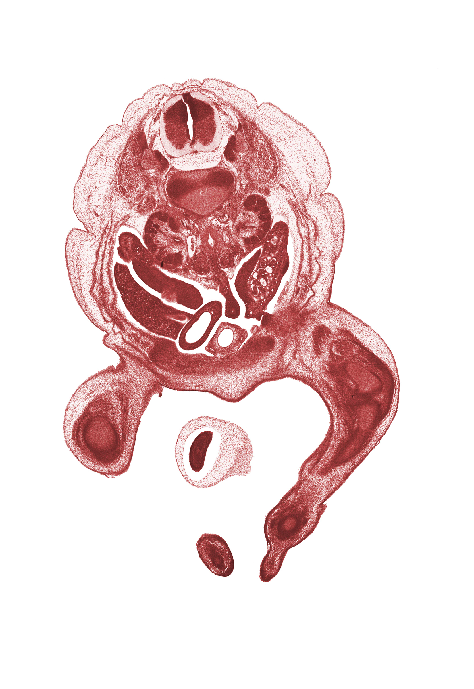 L-1 / L-2 intervertebral disc, L-1 spinal ganglion, L-1 spinal nerve, aorta, caudal edge of proximal limb of herniated midgut, centrum of L-2 vertebra, femur, fibula, gubernaculum of ovary, hindgut, inferior mesenteric artery, kidney (metanephros), knee joint, neural arch, ovary, patella, pubis, right lobe of liver, right umbilical artery, subarachnoid space, tibia, toe of left foot, toe of right foot, umbilical coelom, ureter, urinary bladder