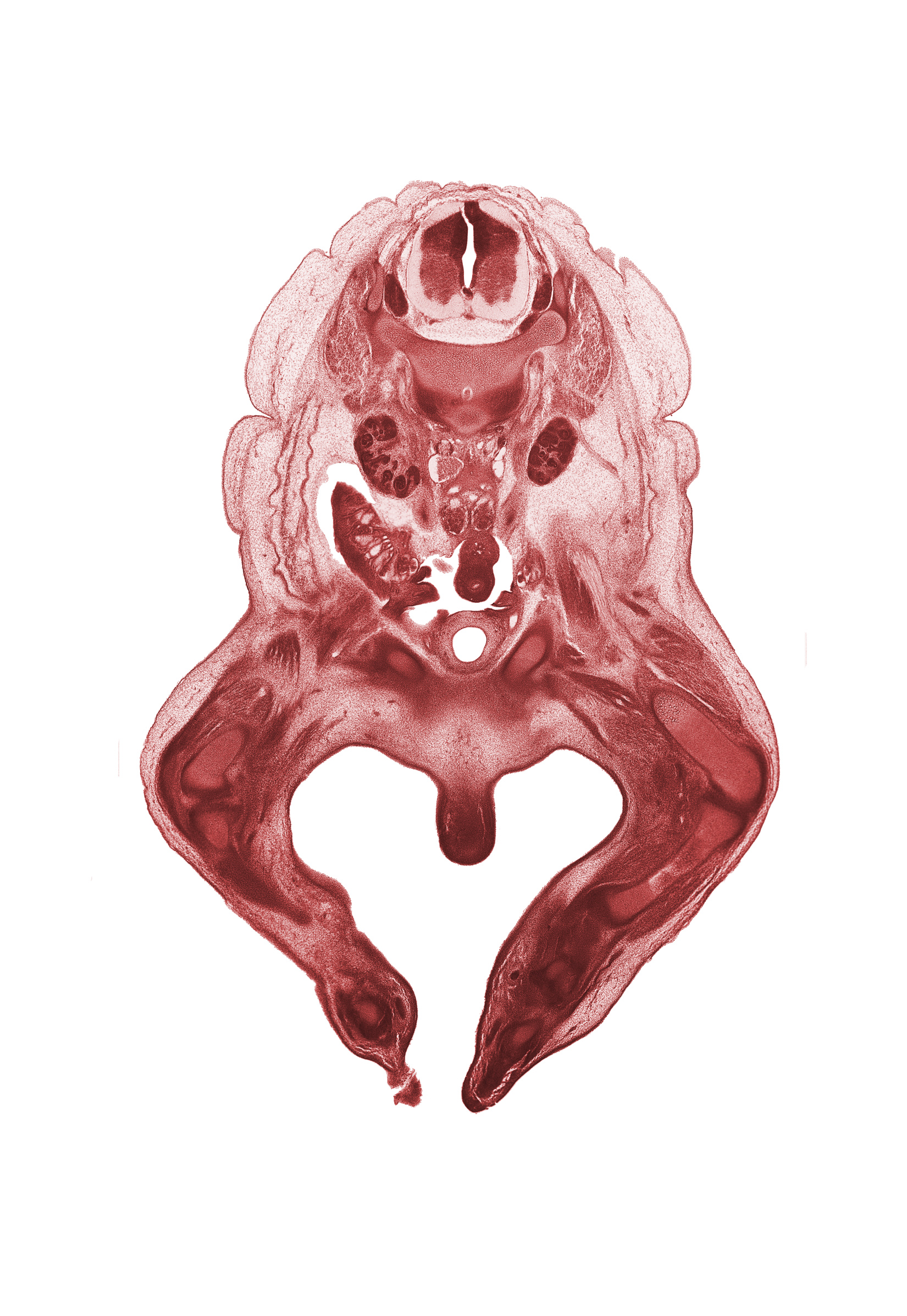 L-1 spinal ganglion, L-2 spinal ganglion, artifact fracture(s), clitoris, femoral nerve, femur, hindgut, kidney (metanephros), knee joint, labial swelling (labium major), median sacral artery, metatarsal(s), patella, psoas major muscle, pubis, quadriceps femoris muscle, right common iliac artery, tarsal region, tibia, ureter
