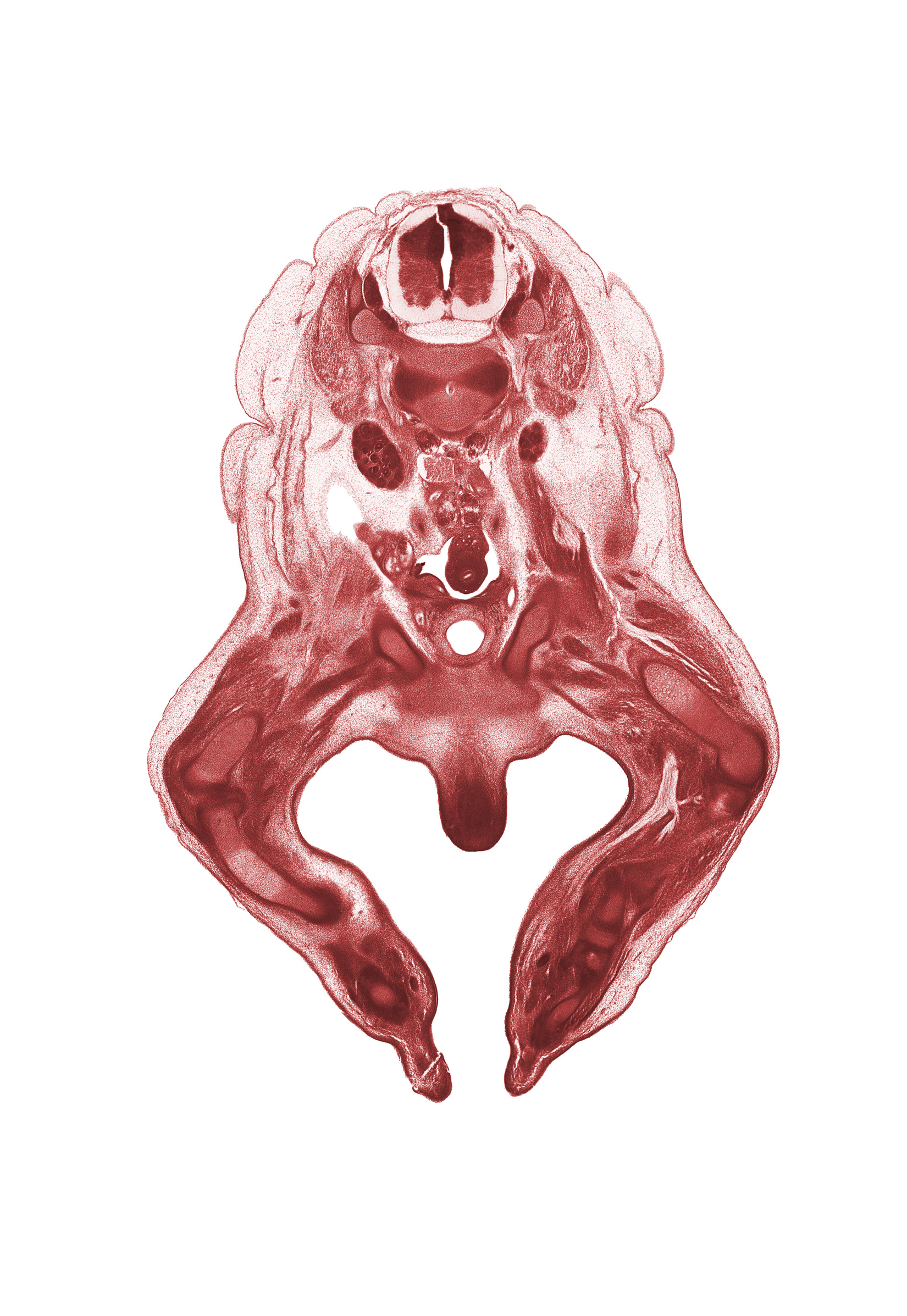 L-2 spinal ganglion, L-2 spinal nerve, artifact fracture(s), external abdominal oblique muscle, femoral nerve, femur, glans clitoris, hindgut, inferior pole of kidney (metanephros), internal abdominal oblique muscle, junction of internal iliac and umbilical arteries, labial swelling (labium major), lateral plantar nerve, medial plantar nerve, obturator nerve, paramesonephric duct, plantar surface of foot, psoas major muscle, pubis, sciatic nerve, tibia, tibial nerve, transversus abdominis muscle, ureter, urinary bladder