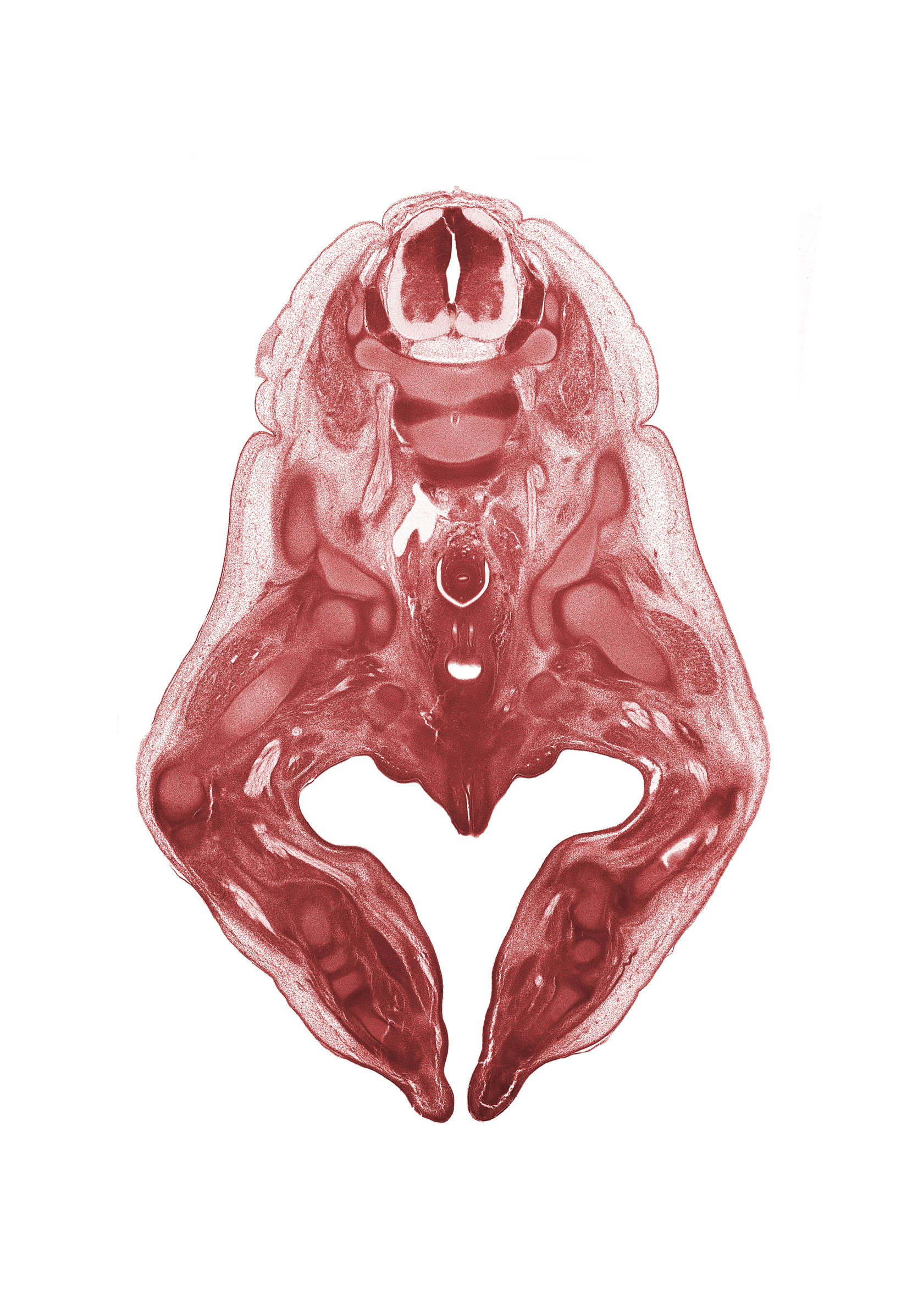 L-2 spinal ganglion, L-3 / L-4 intervertebral disc, L-3 spinal ganglion, femoral artery, hip joint, iliac crest, labial swelling (labium major), labium minor, lumbar plexus, neural arch, paramesonephric duct, peritoneal cavity, sciatic nerve, sympathetic trunk, tibial nerve, urinary bladder, vaginal vestibule