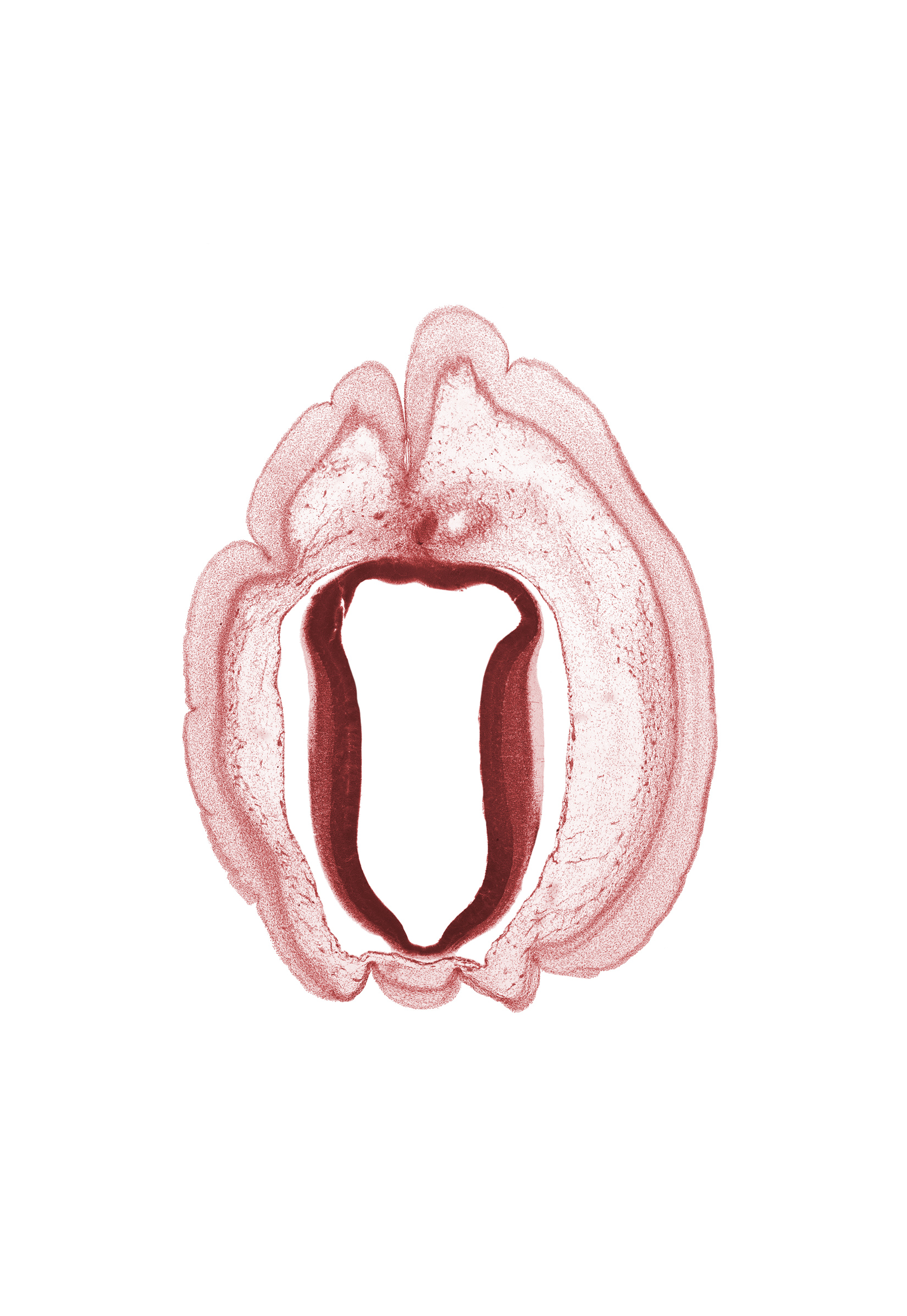 artifact space(s), cephalic edge of metencephalon, cerebral aqueduct (mesocoele), mesencephalon, osteogenic layer, subarachnoid space, surface ectoderm