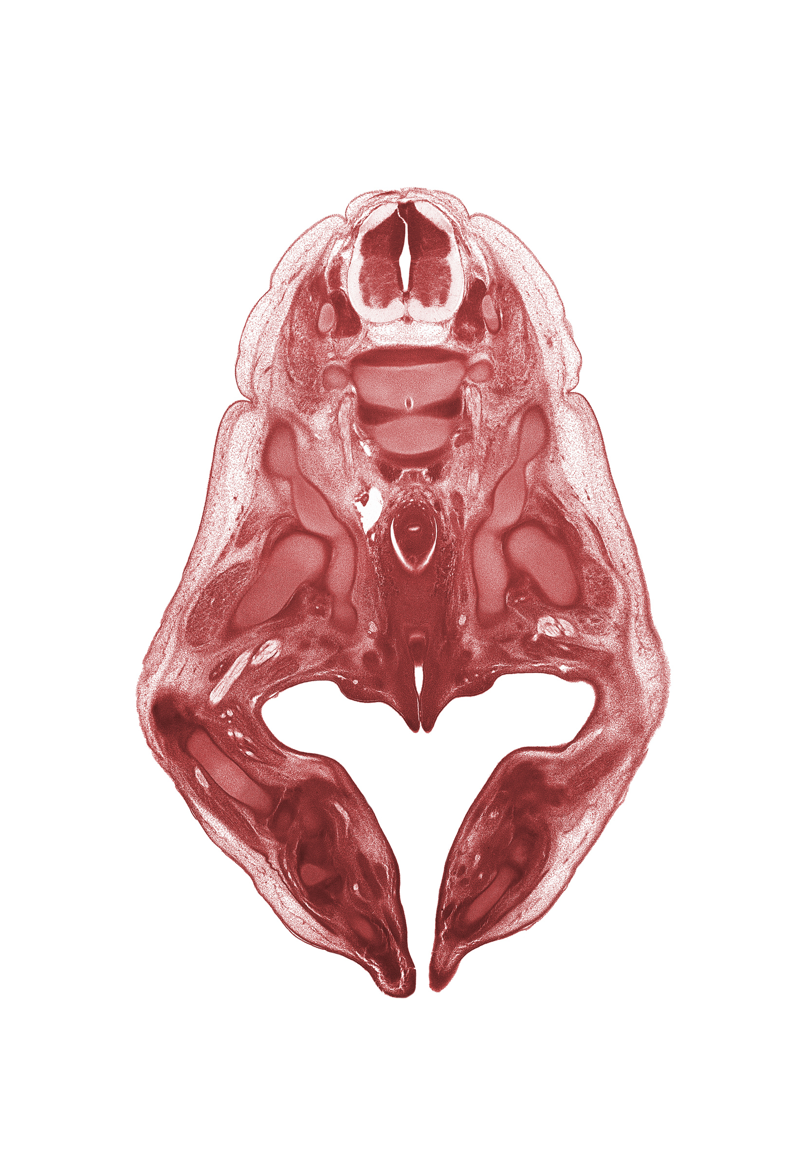 L-3 spinal ganglion, common iliac artery, femoral nerve, hip joint, ischiorectal fossa, ischium, labial swelling, labium minor, lumbosacral trunk, metatarsal(s), neural arch, peritoneal cavity, plantar surface of foot, pudendal nerve, rectum, sciatic nerve, tarsal region, tibia, tibial nerve, urethra, vaginal vestibule