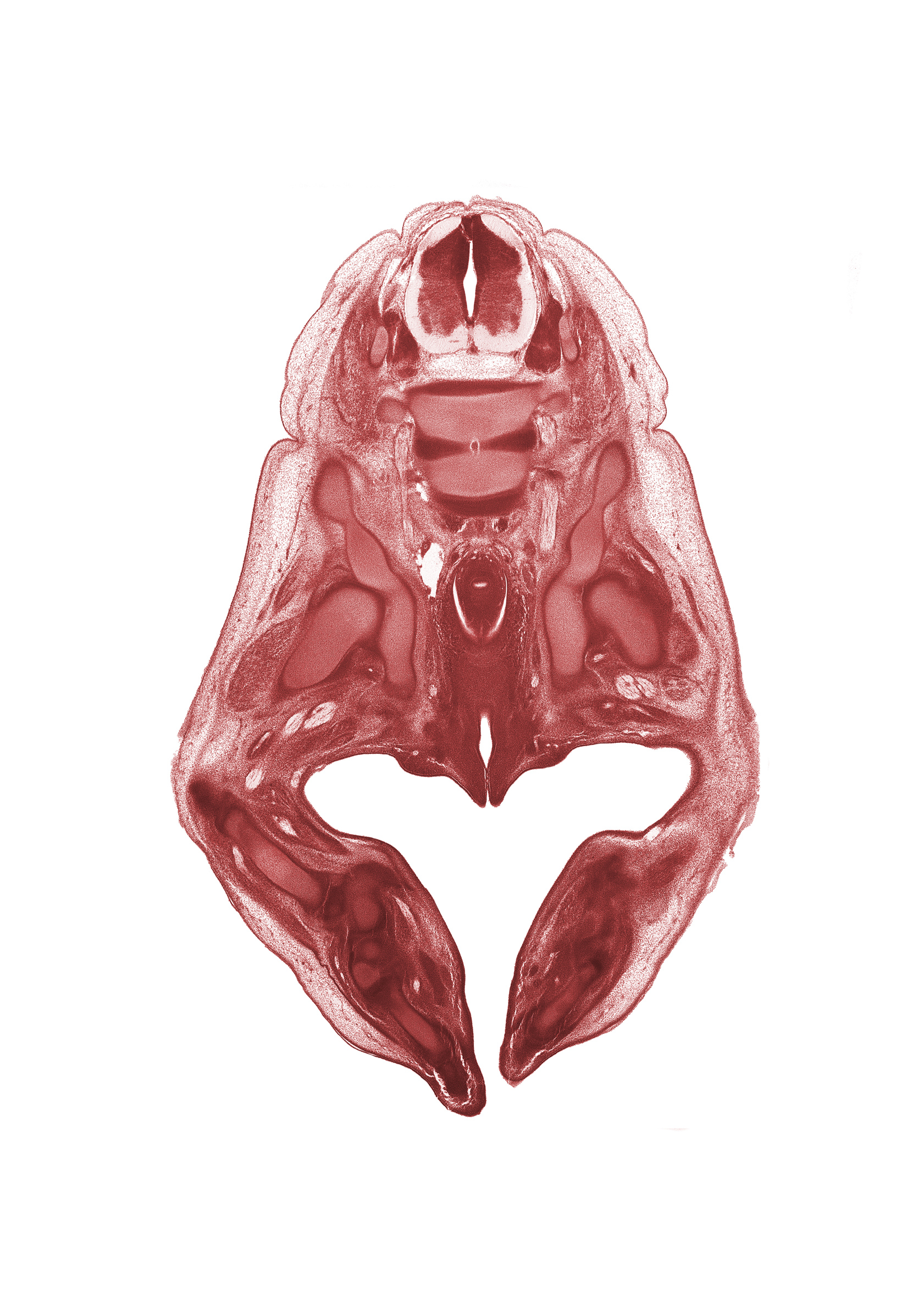 L-3 spinal ganglion, L-4 / L-5 intervertebral disc, fibula, head of femur, hip joint, ilium, ischium, labial swelling, labium minor, metatarsal(s), neural arch of L-3 vertebra, pelvic plexus, peritoneal cavity, rectum, sciatic nerve, sympathetic trunk, tarsal region, vaginal vestibule