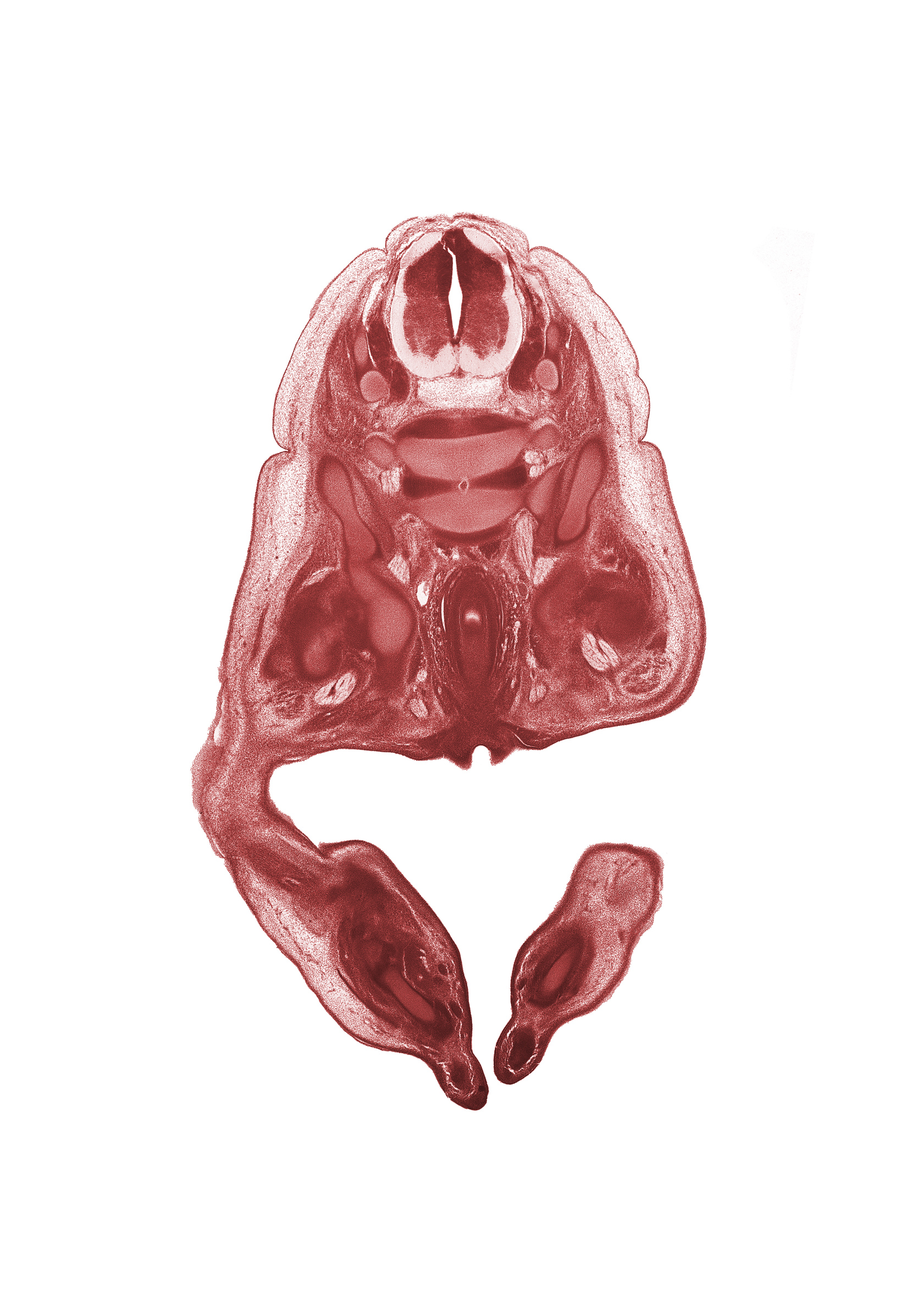 L-4 spinal ganglion, L-4 spinal nerve, L-5 / S-1 intervertebral disc, L-5 ventral primary ramus, alar plate(s), anal fold, anal pit, artifact fracture(s), basal plate, dorsum of foot, floor plate, iliacus muscle, notochord, pelvic plexus, plantar surface of foot, rectum, roof plate, sciatic nerve, sulcus limitans