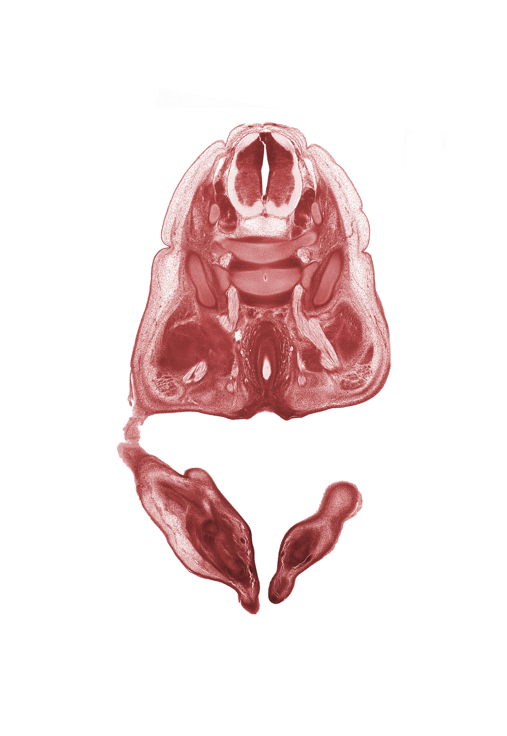 L-4 spinal ganglion, L-5 spinal ganglion, L-5 ventral primary ramus, ala of sacrum, anal fold, anal pit, extensor digitorum tendon, levator ani muscle, metatarsophalangeal joint, neural canal, pelvic plexus, pudendal nerve, rectum, sacro-iliac joint, sciatic nerve, sympathetic trunk