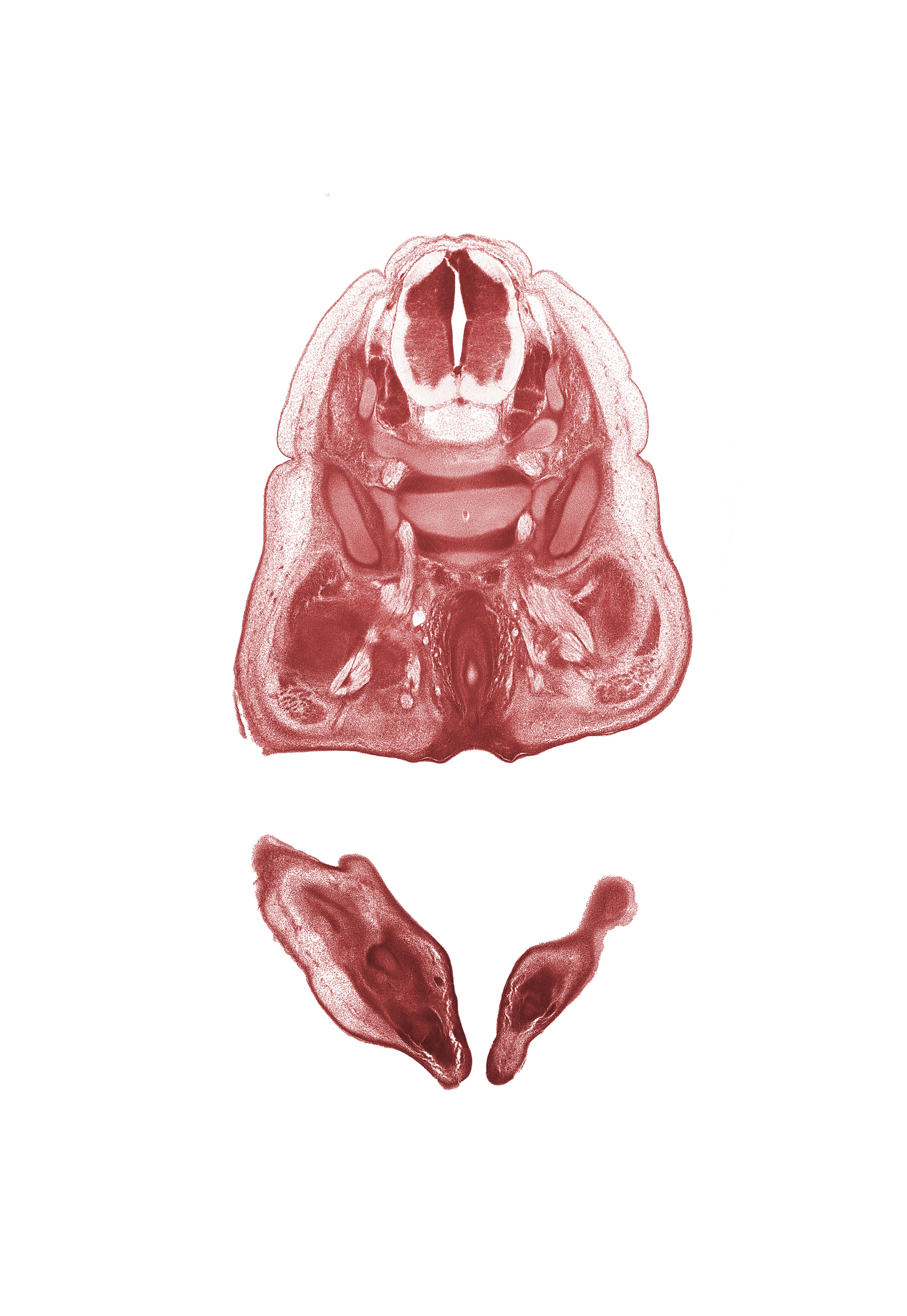 L-4 spinal ganglion, L-5 spinal ganglion, ala of sacrum, anal fold, anal pit, anterior spinal artery, dorsal horn of grey matter, gluteus medius muscle, gluteus minimus muscle, pudendal nerve, rectum, right foot, superior gluteal nerve, sympathetic trunk, ventral horn of grey matter