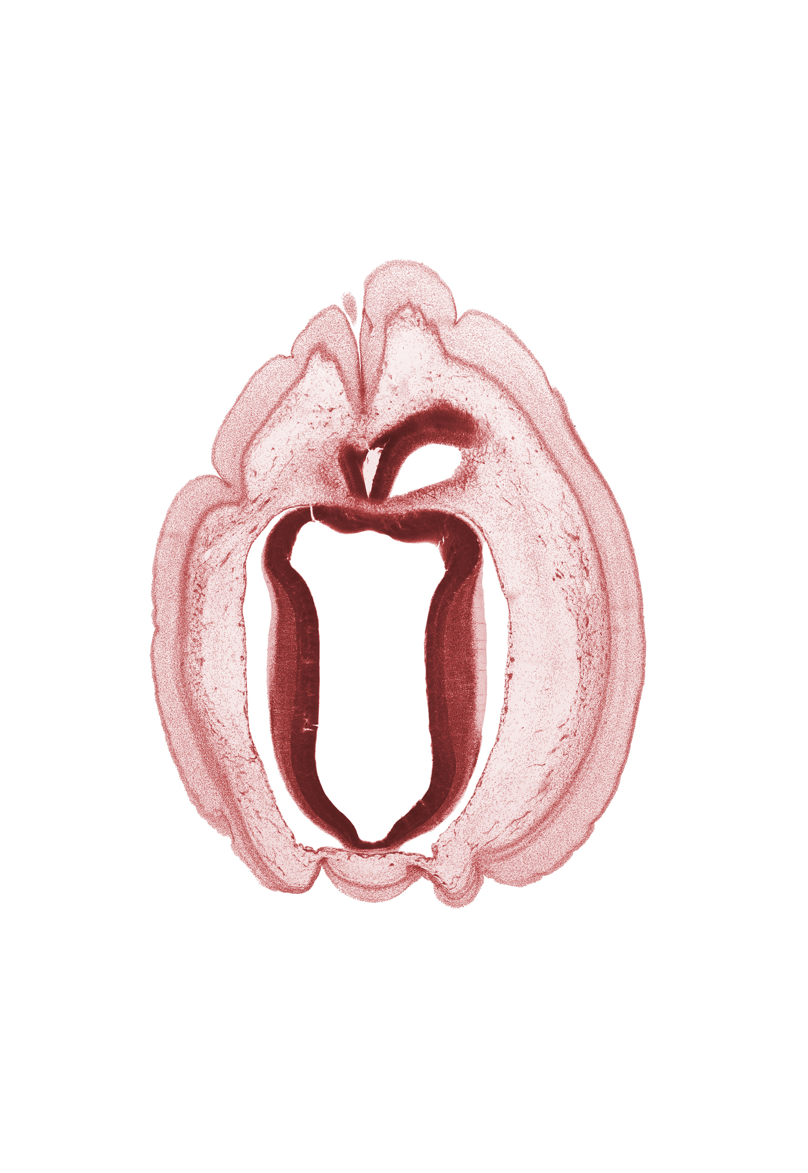 alar plate of mesencephalon, edge of rhombencoel (fourth ventricle), intermediate zone, marginal zone, roof plate of mesencephalon, ventricular zone