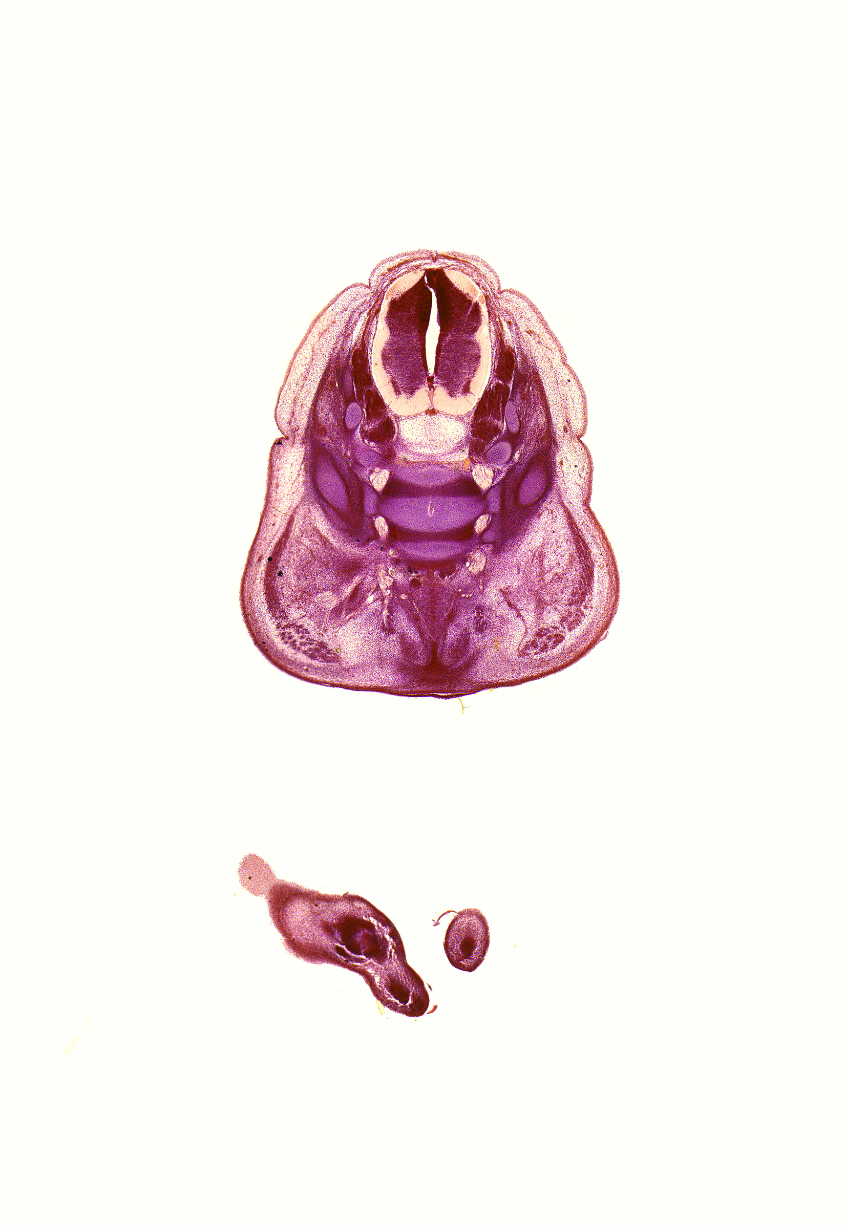 L-4 spinal ganglion, L-5 spinal ganglion, L-5 spinal nerve, S-1 / S-2 intervertebral region, S-1 ventral primary ramus, caudal eminence, dorsal fasciculus, gluteus maximus muscle, left foot, levator ani muscle, right foot, subarachnoid space, sympathetic trunk