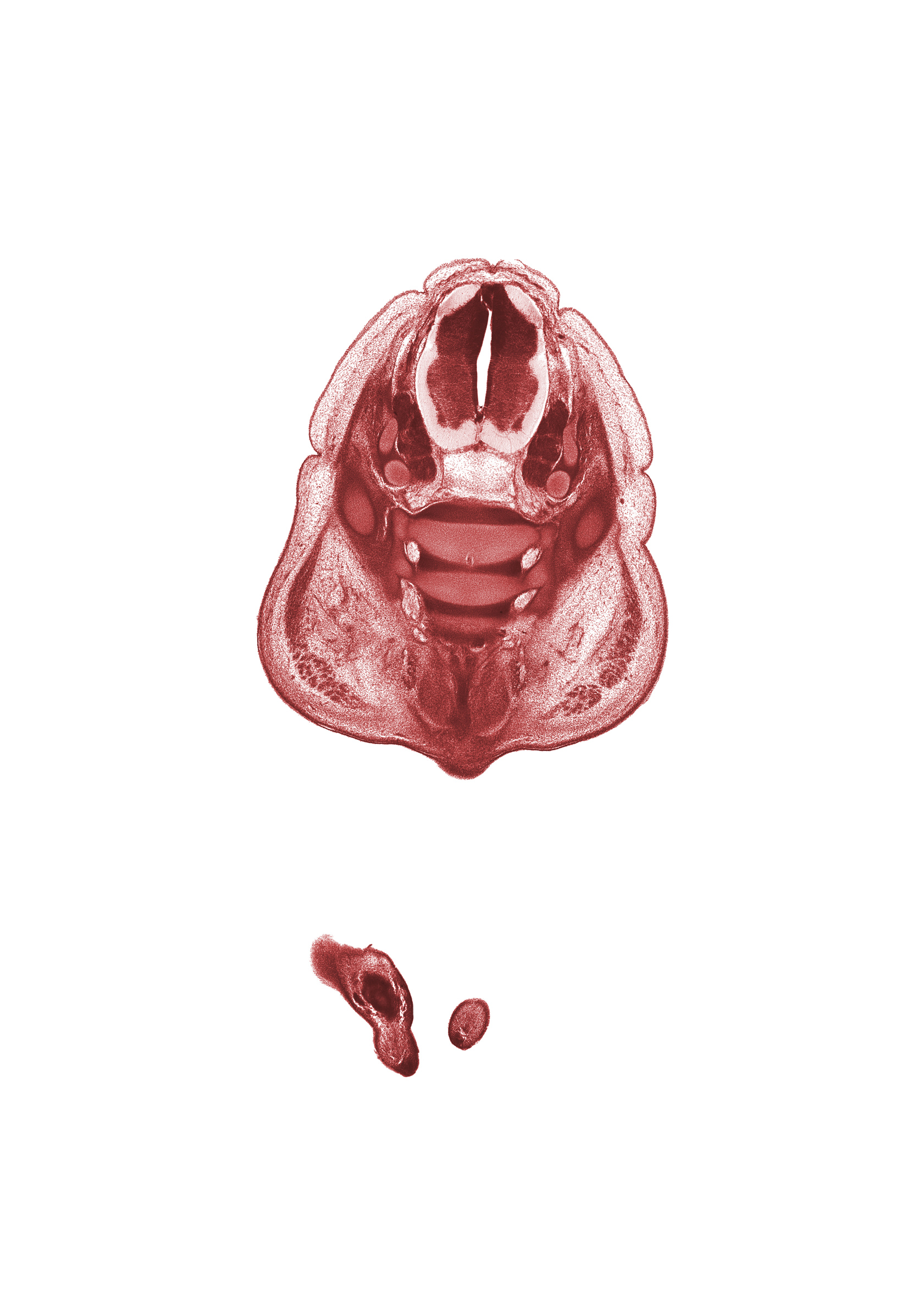 L-4 spinal ganglion, L-5 spinal ganglion, ala of sacrum, caudal edge of left foot, caudal eminence, dorsum of right foot, edge of ilium, gluteus maximus muscle, ischiorectal fossa, levator ani muscle, neural arch of L-5 vertebra, notochord, subarachnoid space