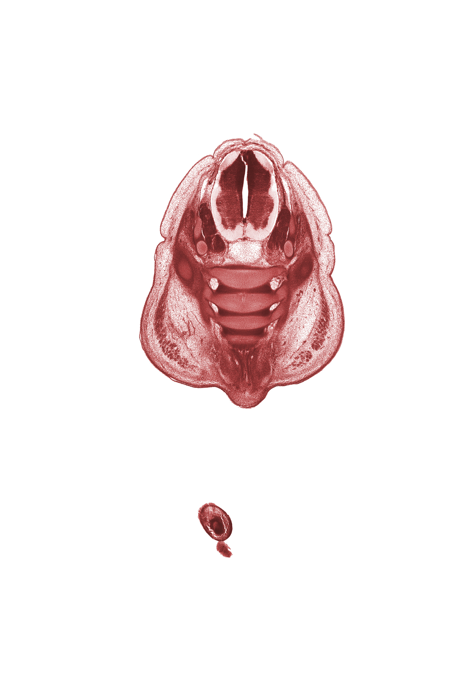 L-5 spinal ganglion, L-5 spinal nerve, S-1 ventral primary ramus, S-2 ventral primary ramus, caudal eminence, dorsal fasciculus, gluteus maximus muscle, notochord, right foot, sacrum, subarachnoid space