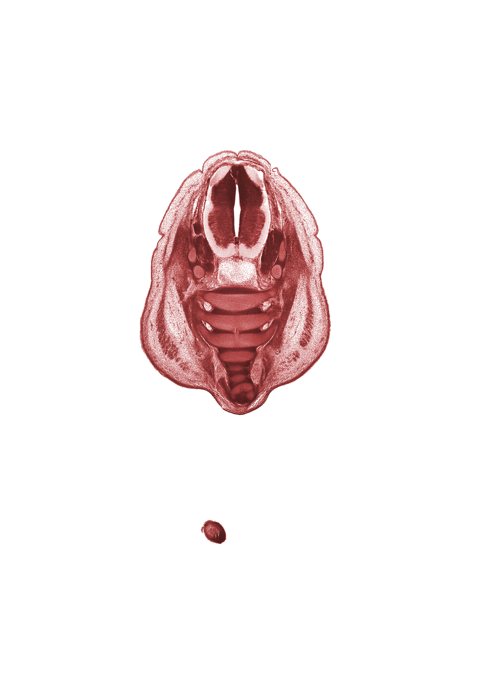 S-1 spinal ganglion, S-1 spinal nerve, S-3 ventral primary ramus, alar plate(s), basal plate, caudal edge of right foot, caudal eminence, central canal, centrum of S-2 vertebra, coccygeal plexus, coccyx, dorsal fasciculus, filum terminale, floor plate, gluteus maximus muscle, levator ani muscle, roof plate, sulcus limitans, surface ectoderm