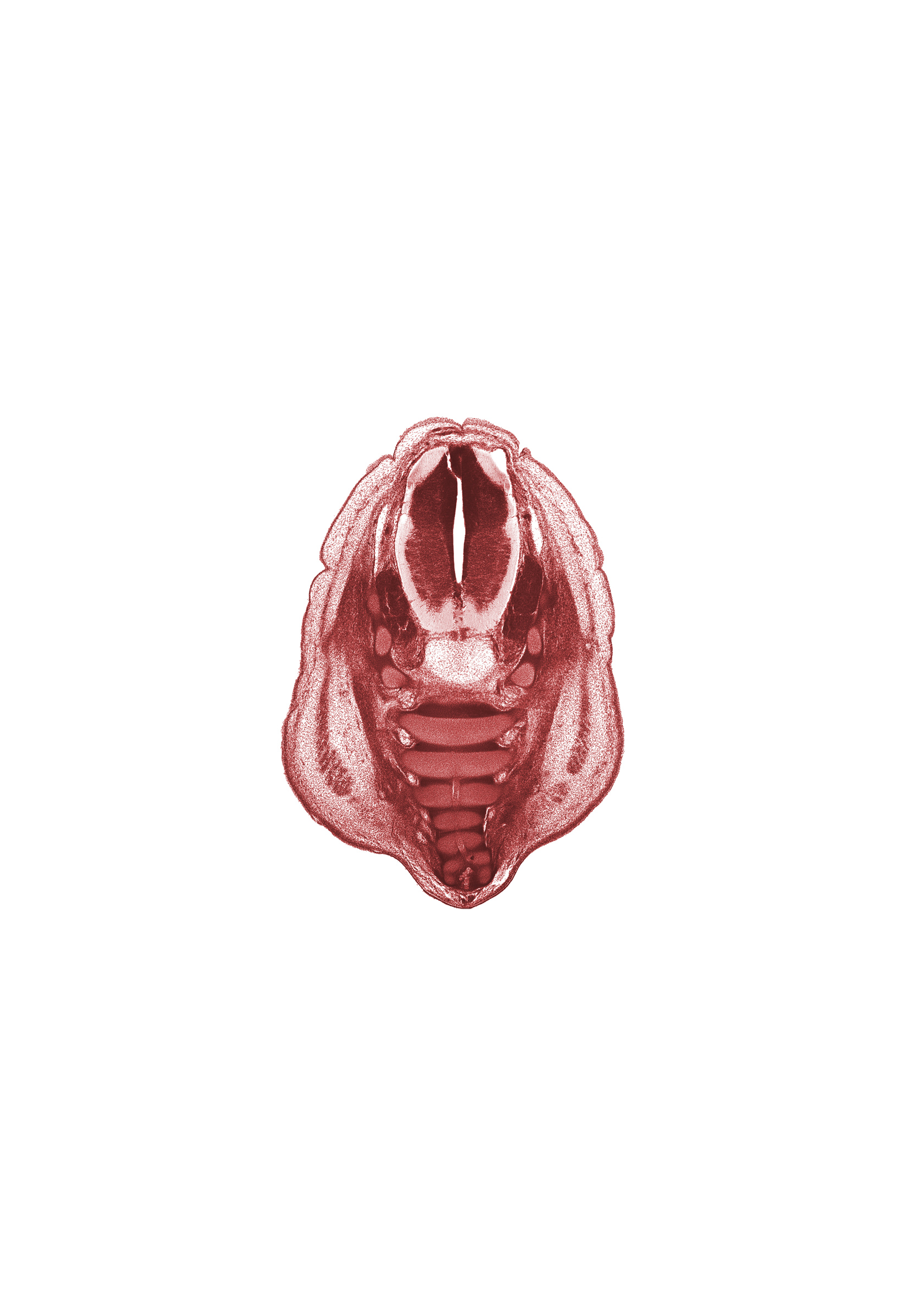 S-1 spinal ganglion, S-2 ventral primary ramus, anterior spinal artery, central canal, coccyx, filum terminale, gluteus maximus muscle, neural arch of S-2 vertebra, notochord, osteogenic layer, subarachnoid space