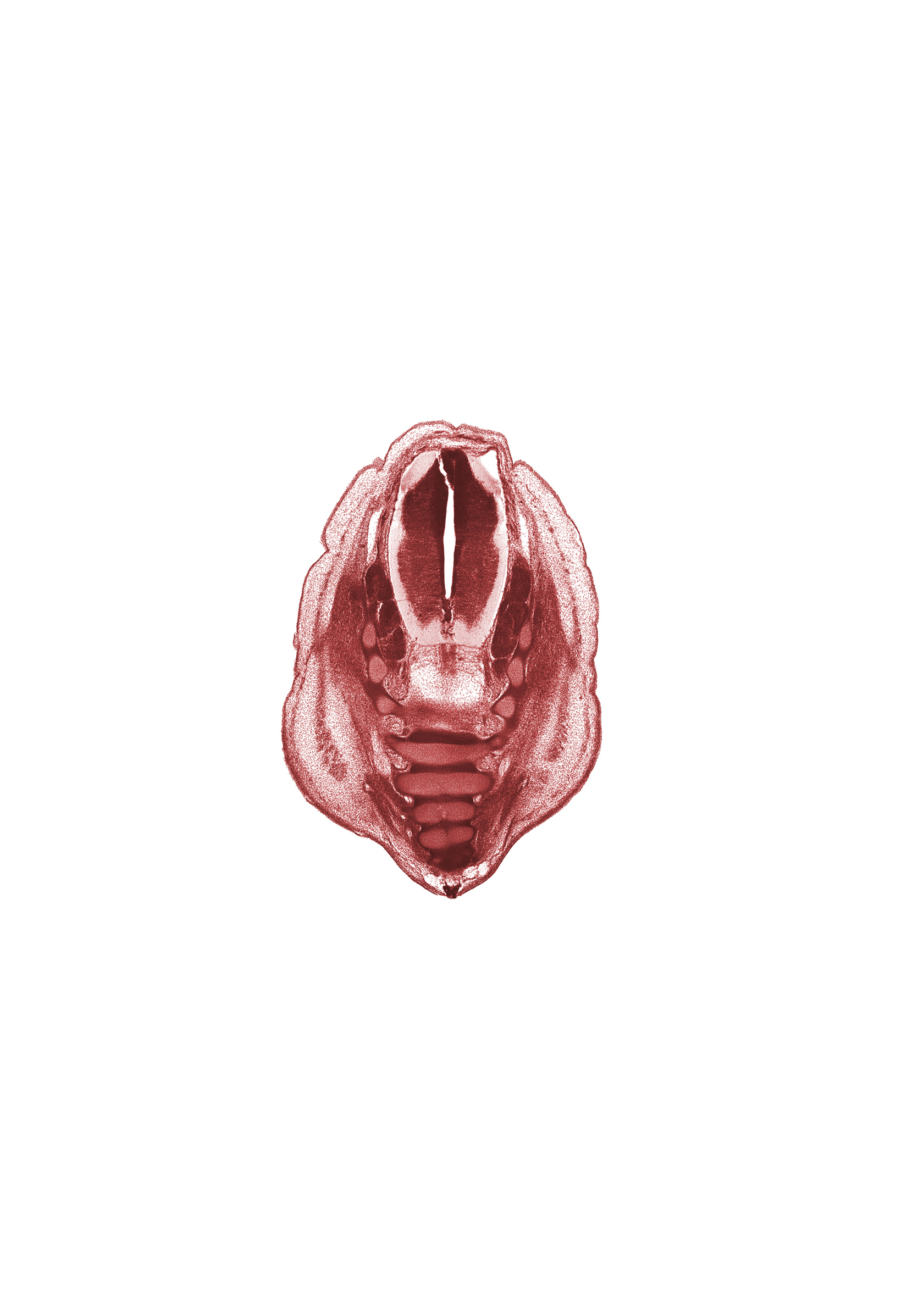 L-5 spinal ganglion, S-1 spinal ganglion, S-2 spinal ganglion, S-3 ventral primary ramus, S-4 / S-5 intervertebral region, S-4 ventral primary ramus, artifact separation(s), caudal eminence, centrum of S-5 vertebra, coccyx, filum terminale, neural arch, neural arch of S-2 vertebra, neural arch of S-4 vertebra, osteogenic layer, spinalis muscle